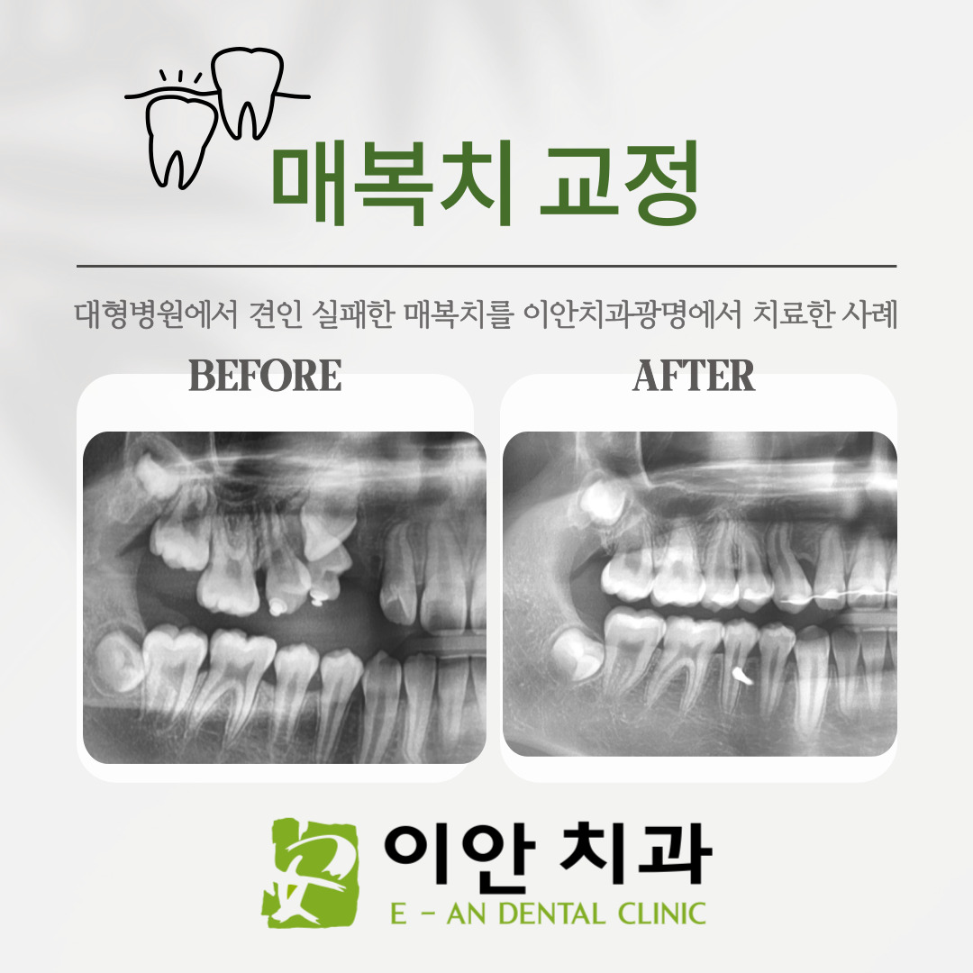 이안치과의원 광명 대표 이미지