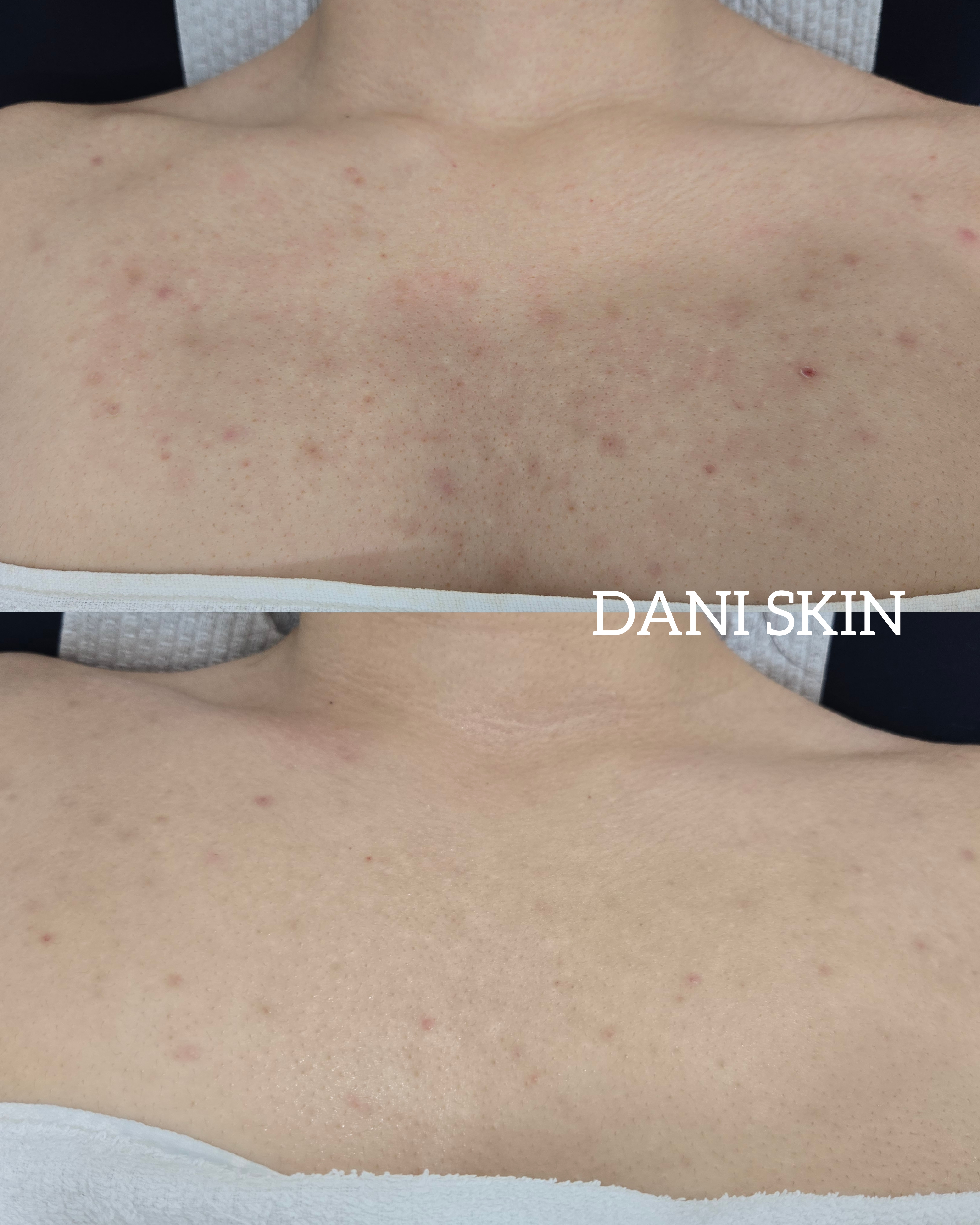 다니스킨 대표 이미지