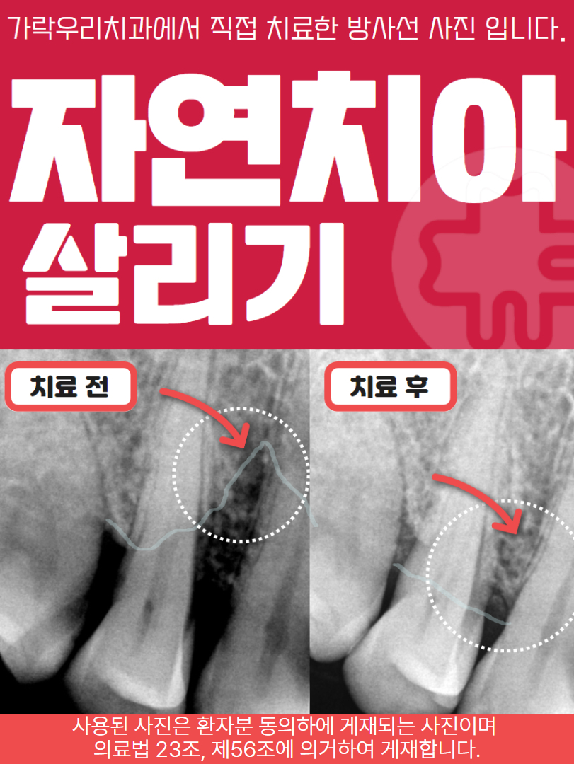 가락우리치과의원 대표 이미지