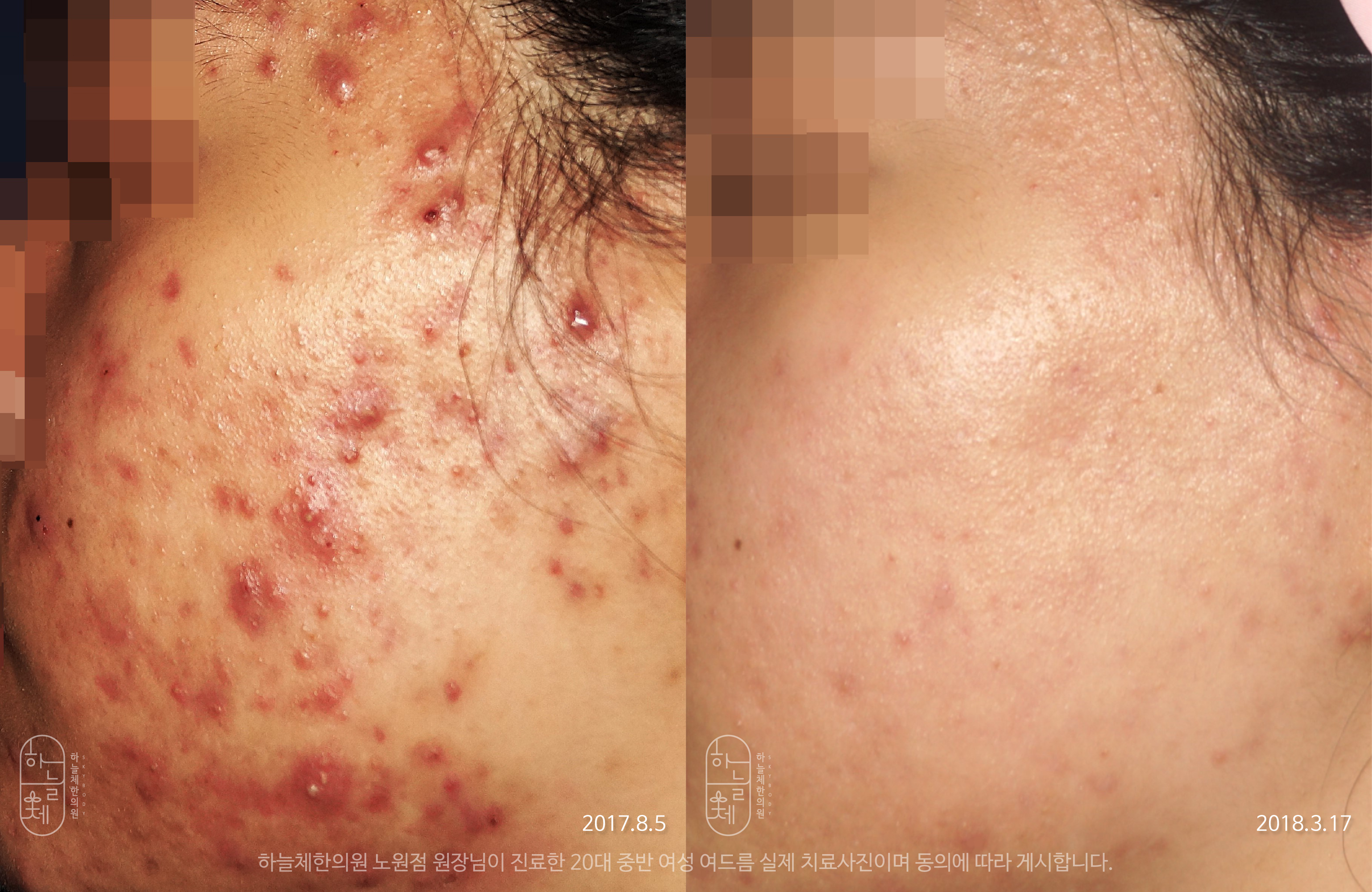 하늘체한의원 노원 대표 이미지