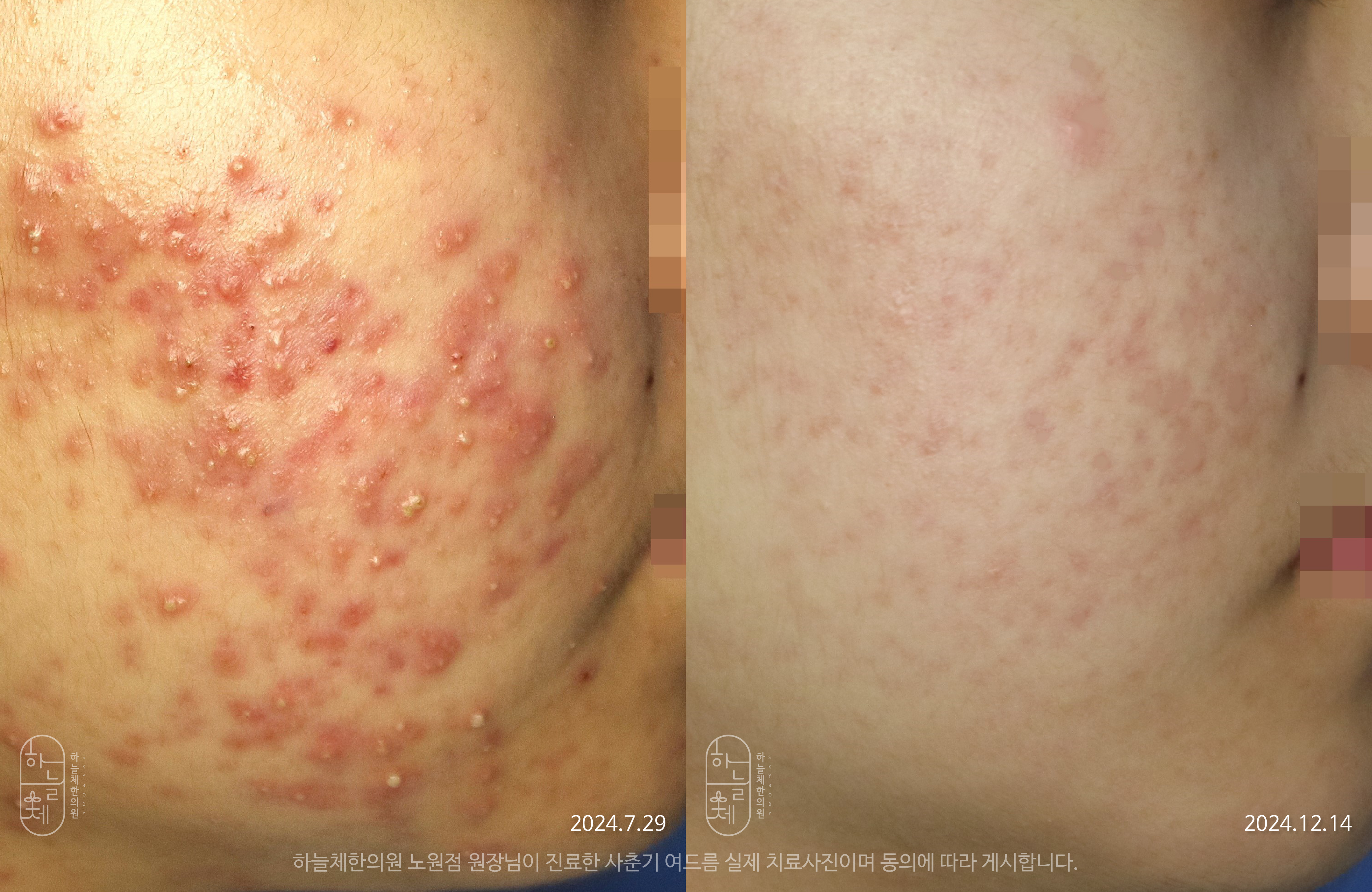 하늘체한의원 노원 대표 이미지