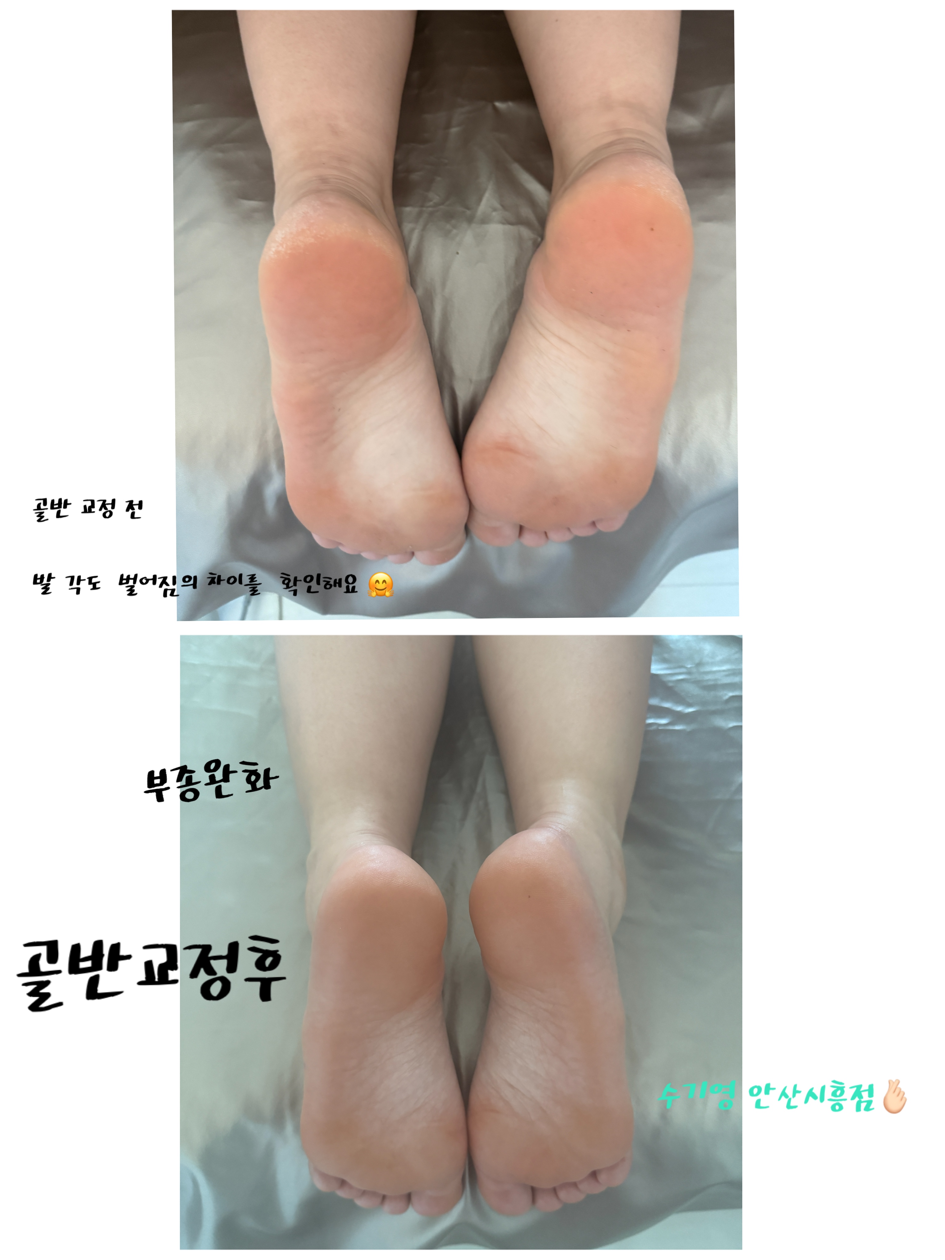 수기영 안산시흥 photo 7