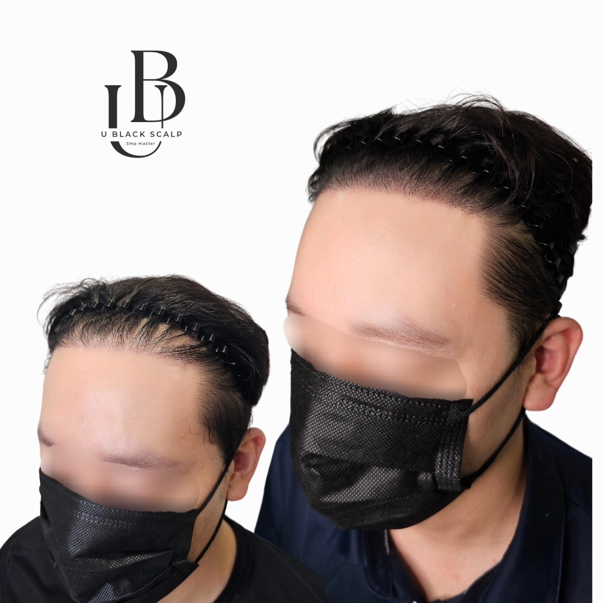 유블랙 대표 이미지