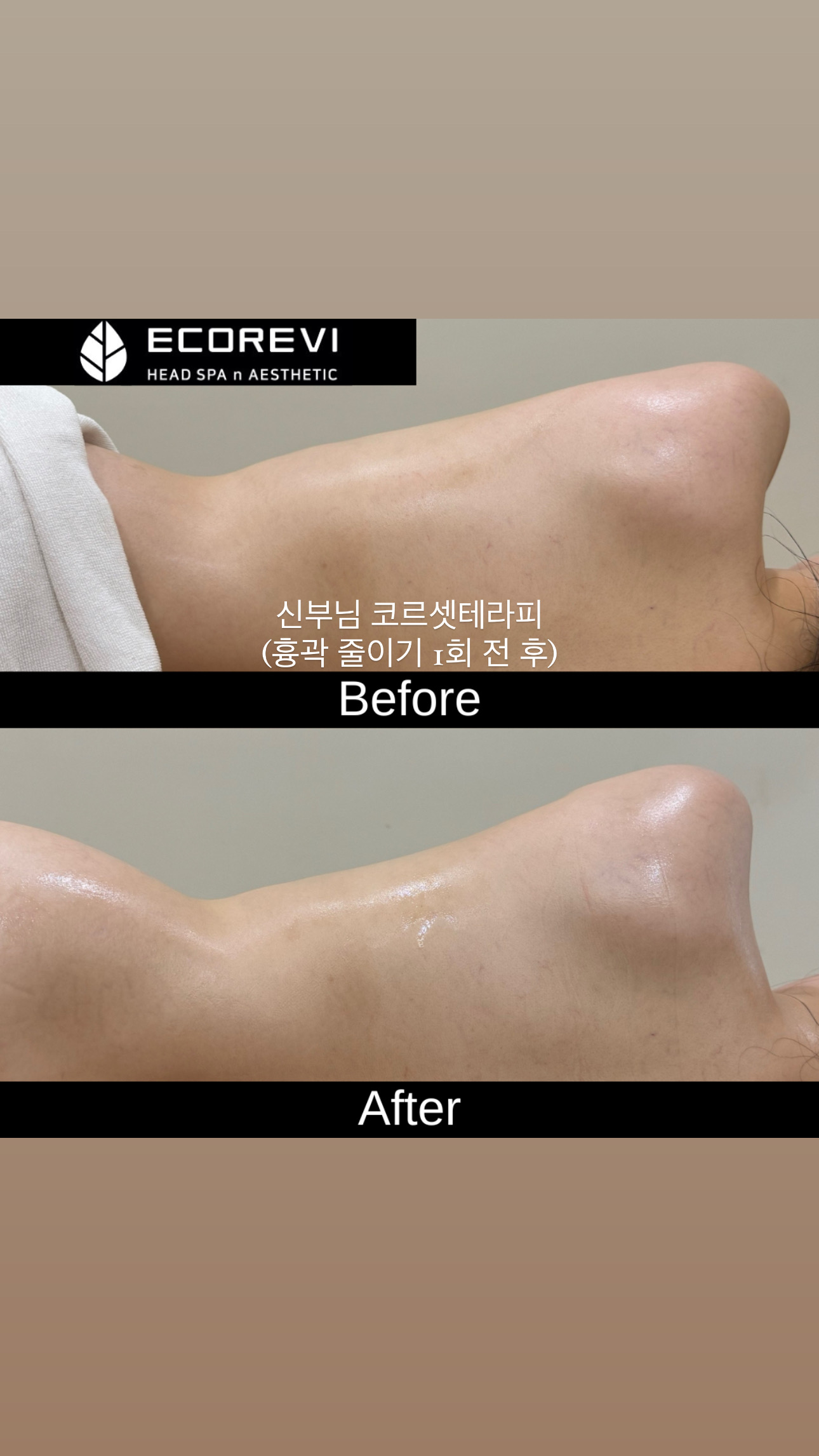 에코레비 헤드스파 앤 에스테틱 기장일광점 대표 이미지