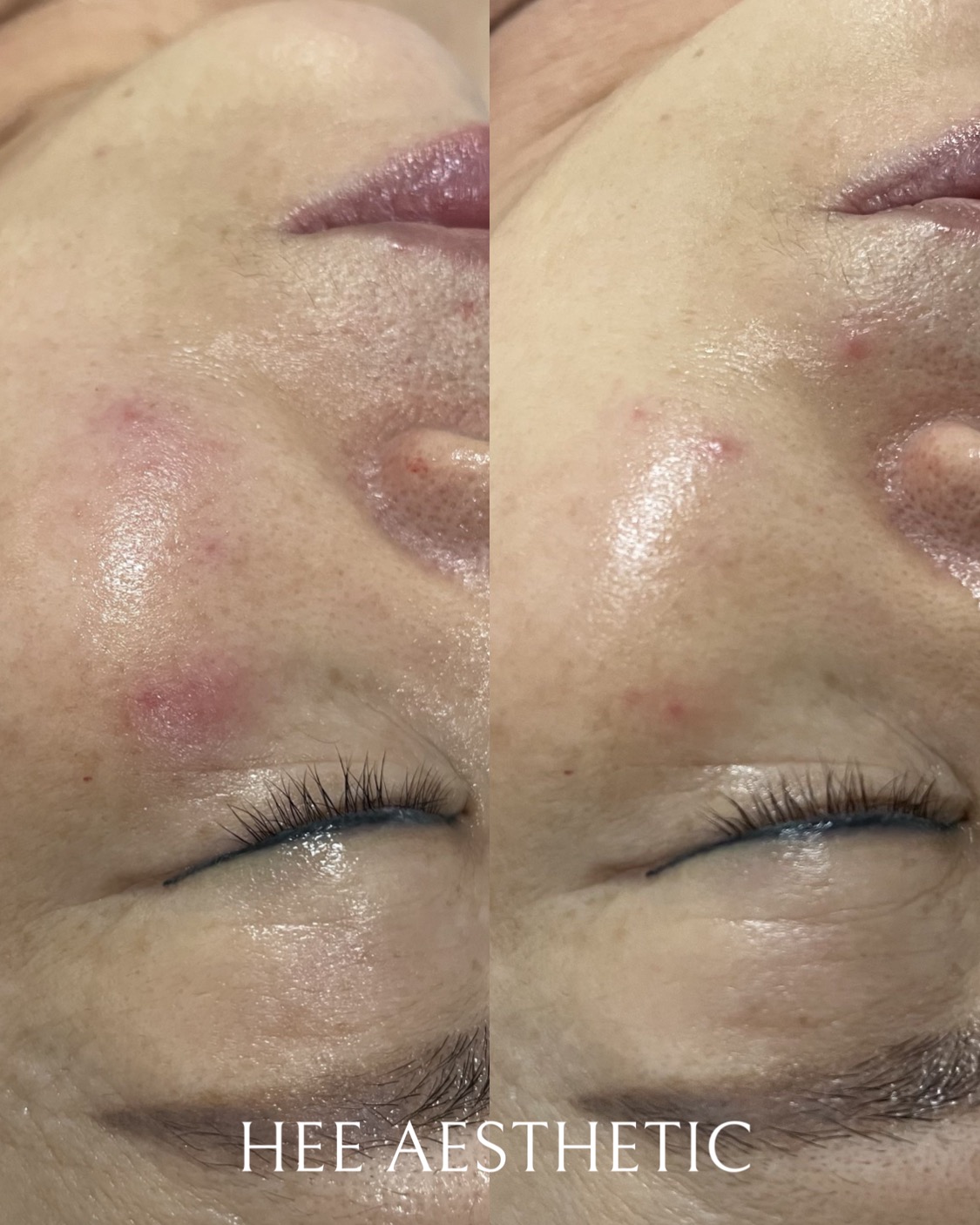 희에스테틱 안산점 대표 이미지