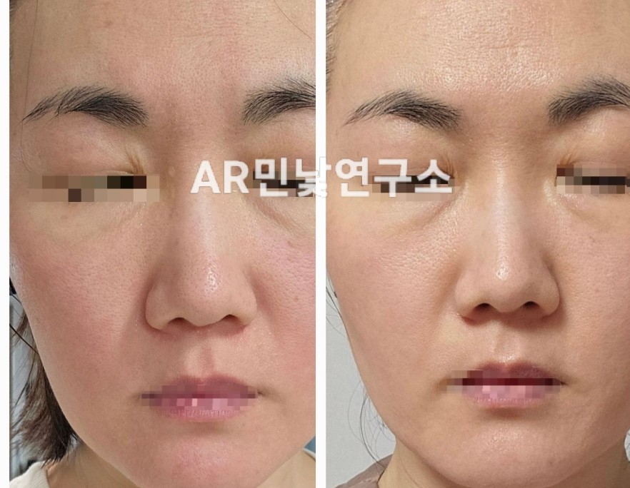AR 민낯 연구소