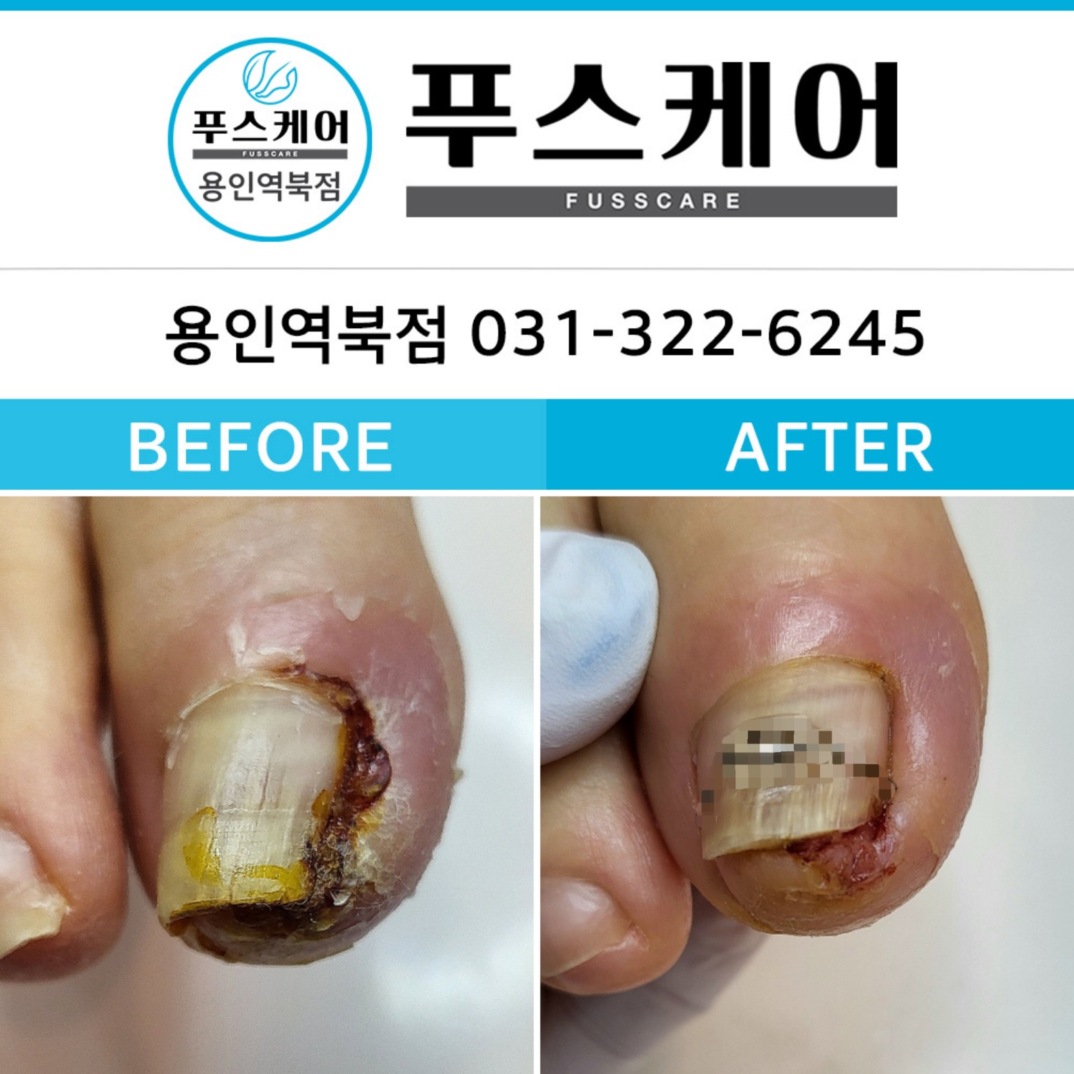 푸스케어 용인역북점