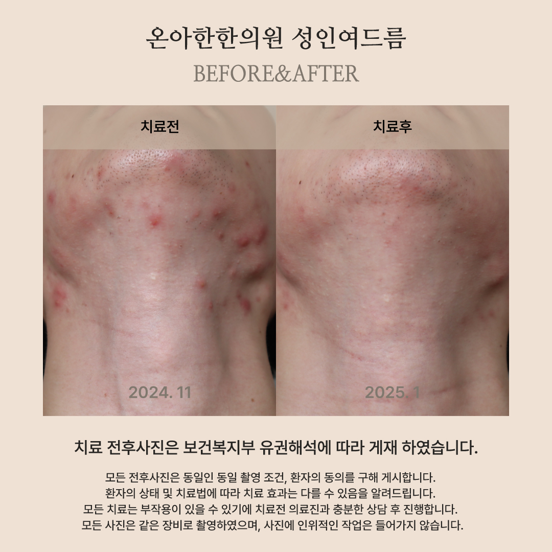 온아한한의원 잠실 대표 이미지