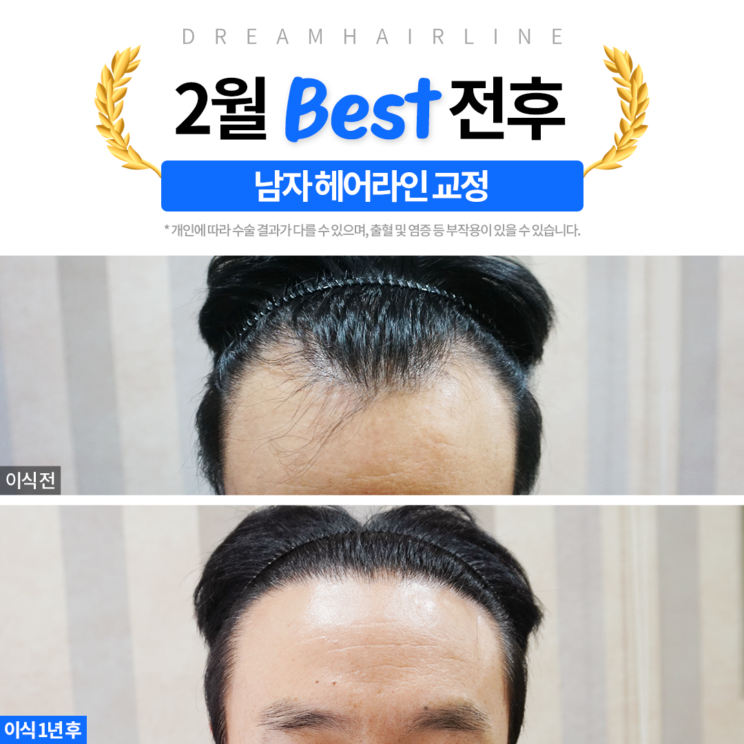 드림헤어라인의원