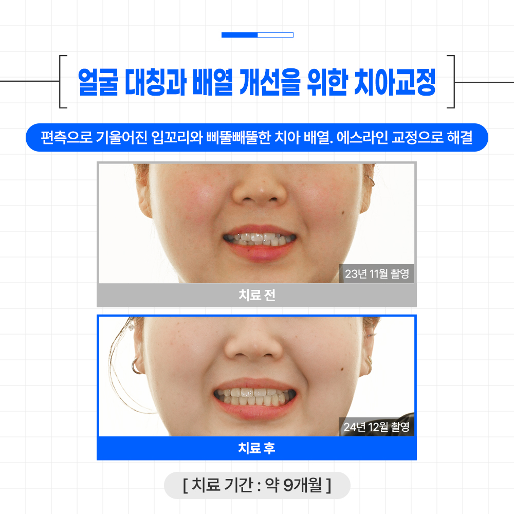 글로리치과교정과치과의원 대표 이미지