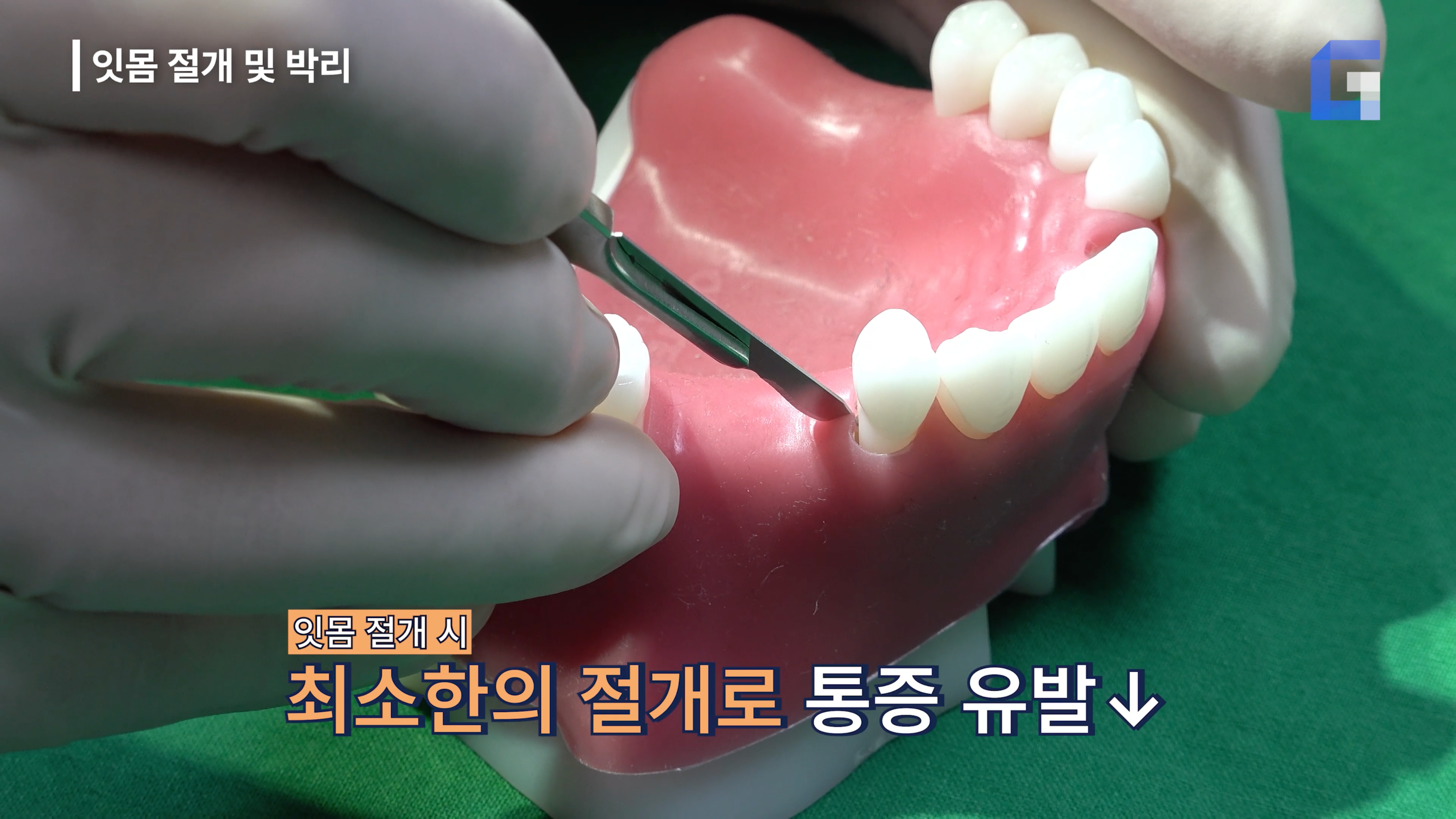 서울그랜드치과 대표 이미지