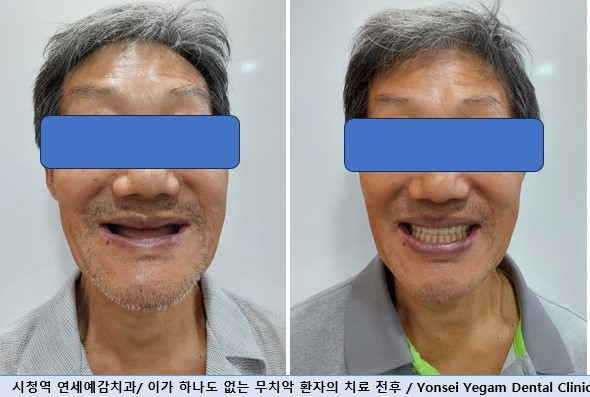 연세예감치과의원 대표 이미지