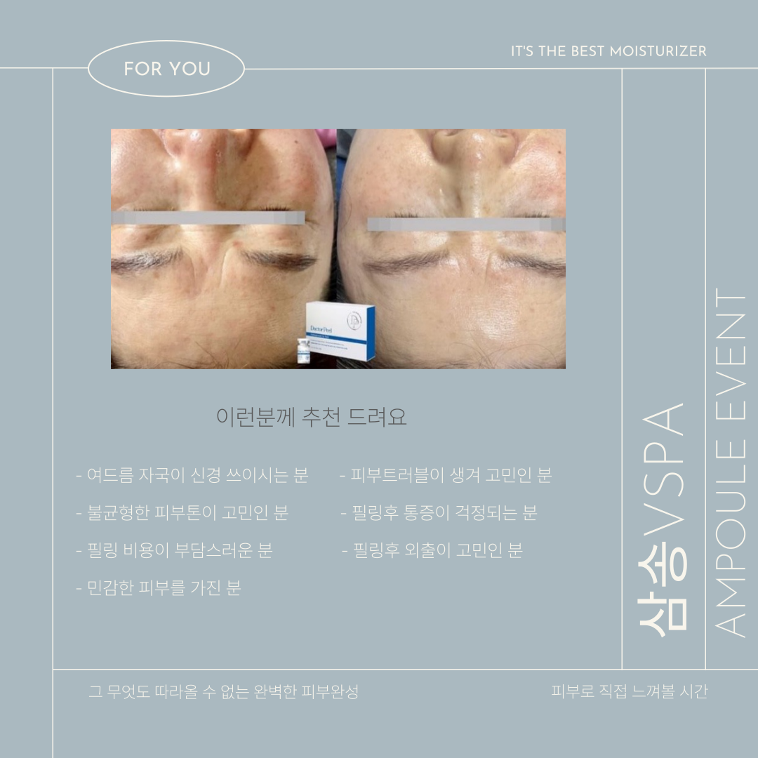 브이스파 photo 3