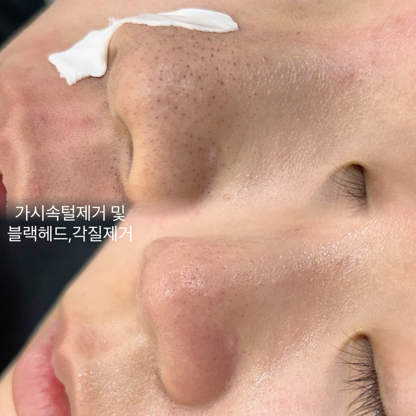 바이엘왁싱 대표 이미지