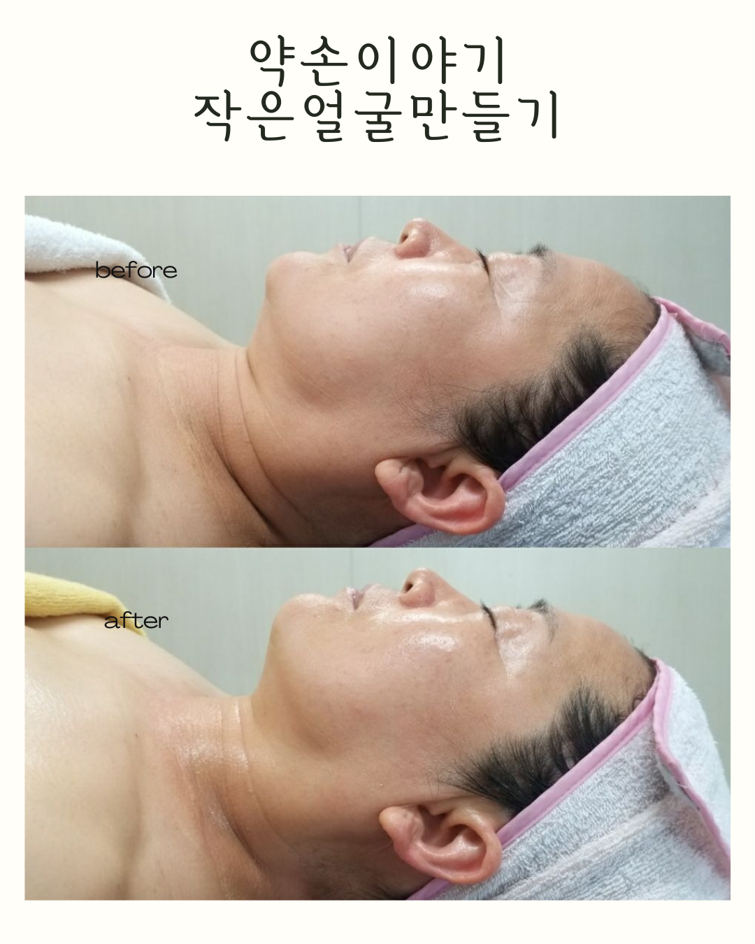 약손이야기 작은얼굴만들기 photo 9