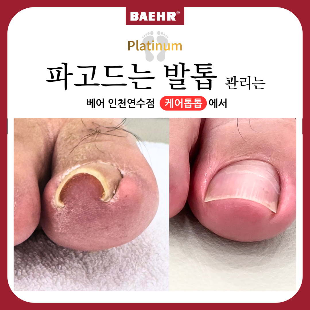 케어톱톱 & 베어푸스플레게 대표 이미지