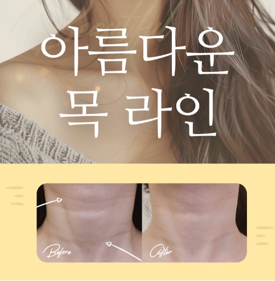 유투성형외과의원 대표 이미지