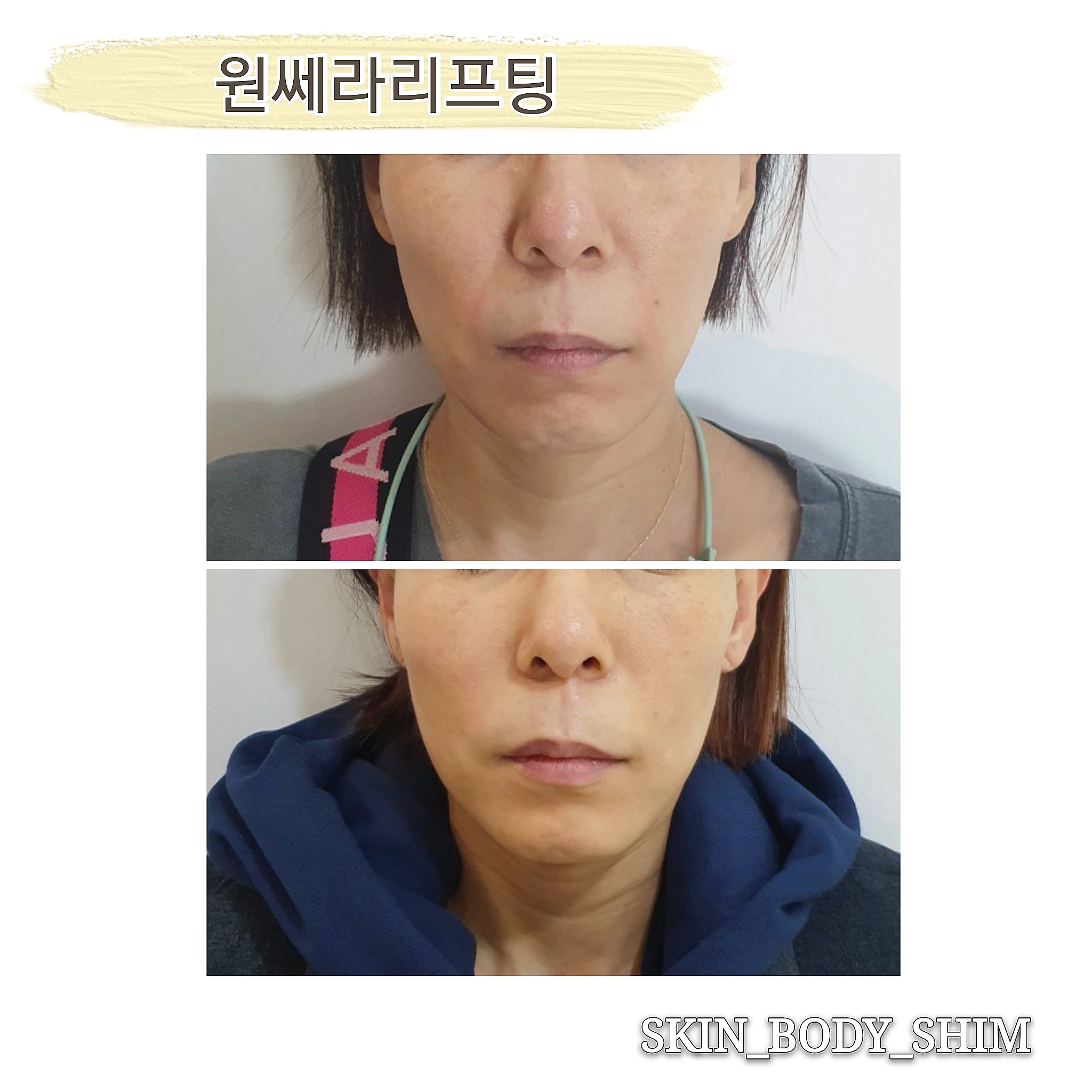 스킨앤바디 쉼