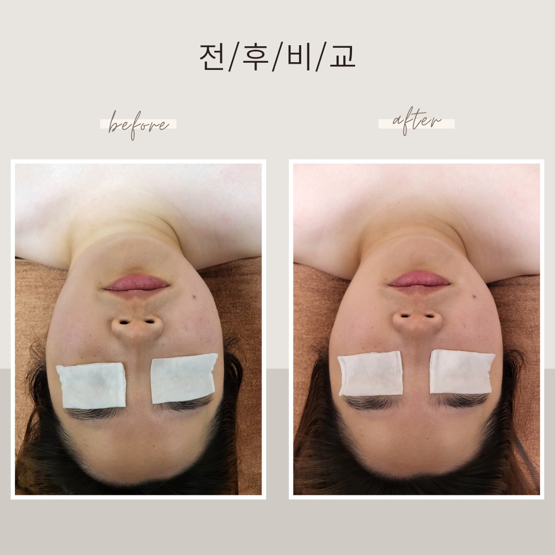 스킨앤바디 쉼