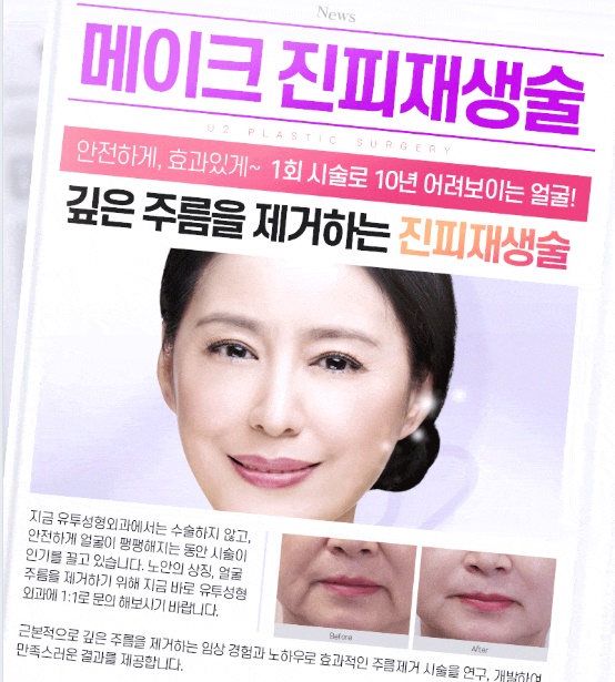 유투성형외과의원 대표 이미지