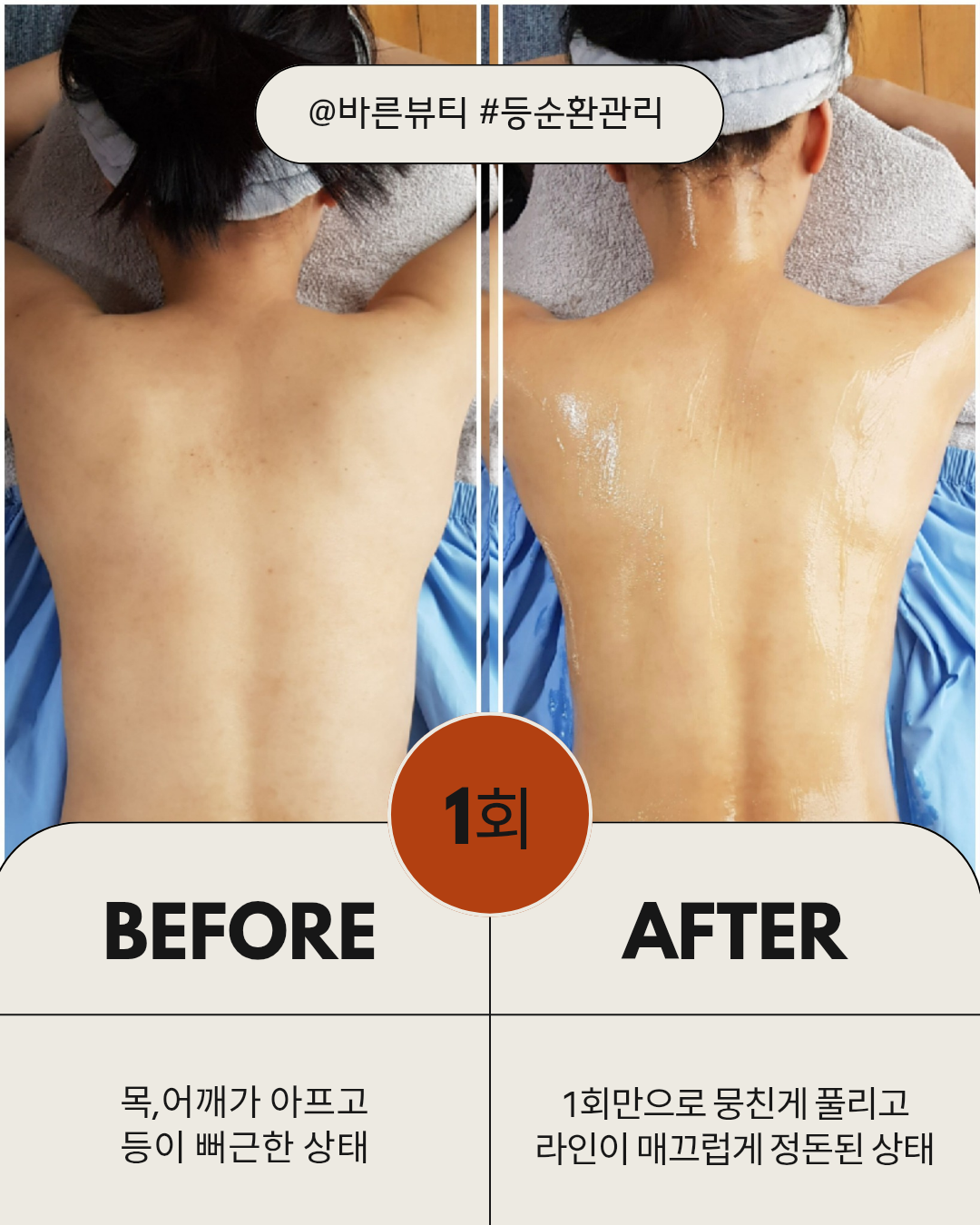 바른뷰티 photo 2