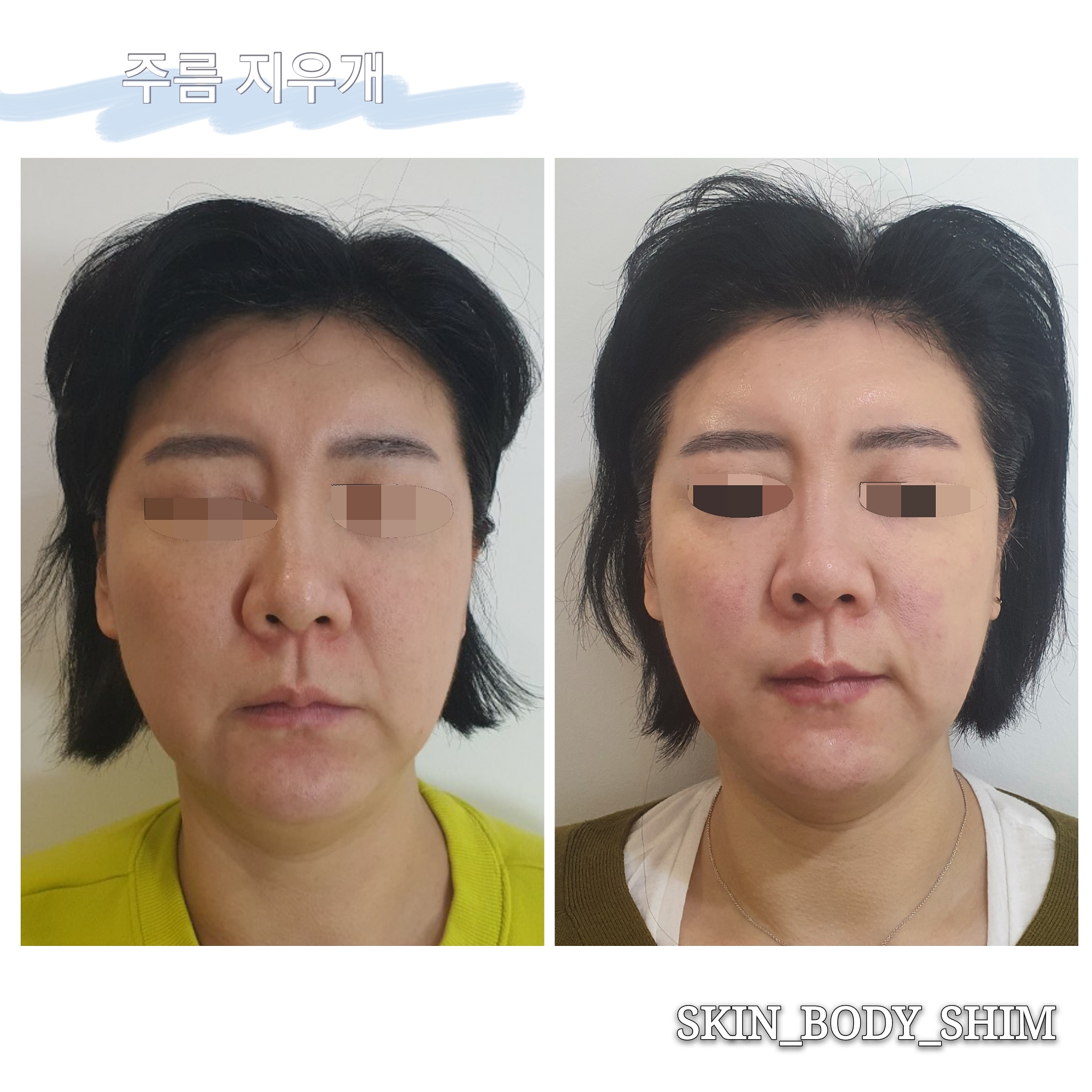 스킨앤바디 쉼