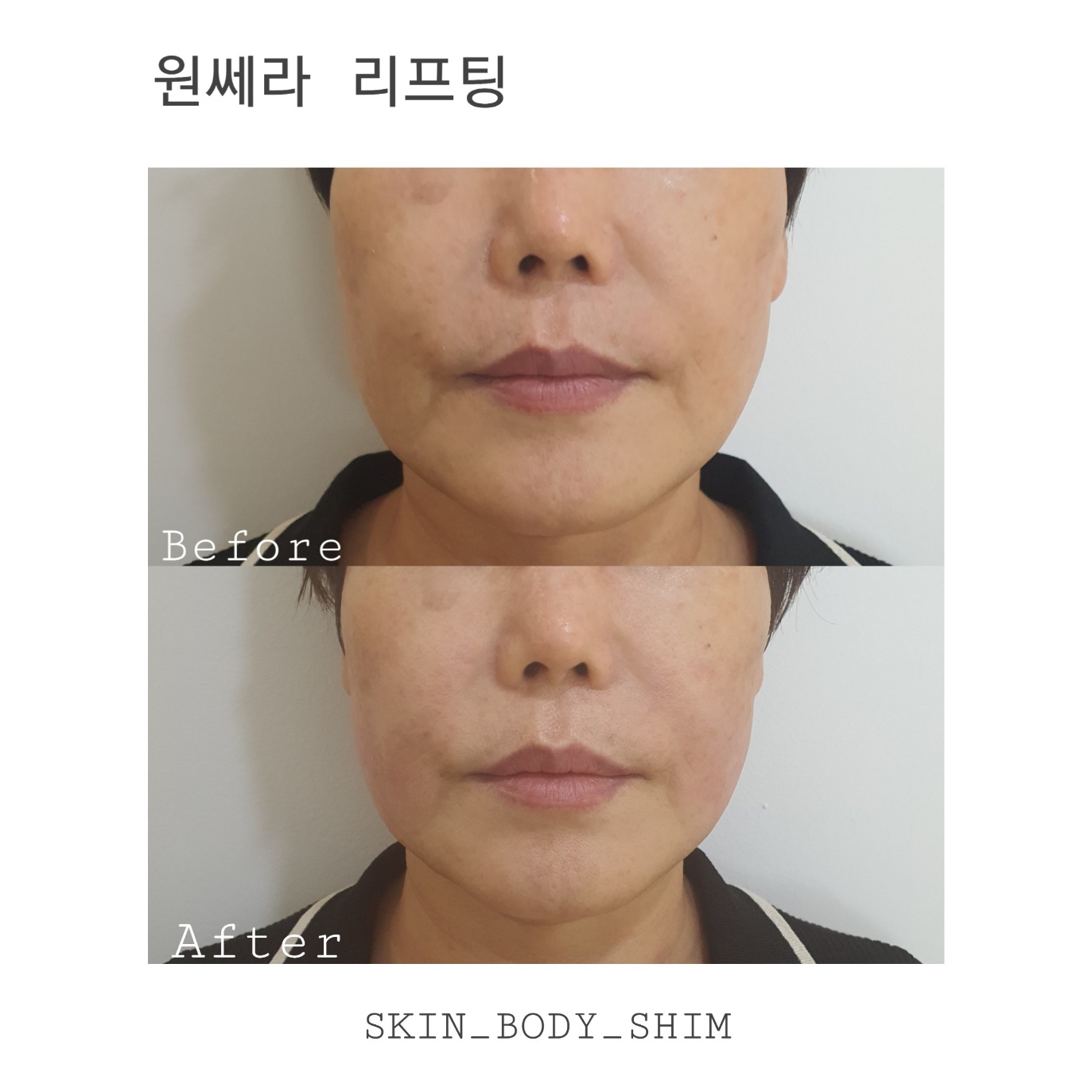 스킨앤바디 쉼