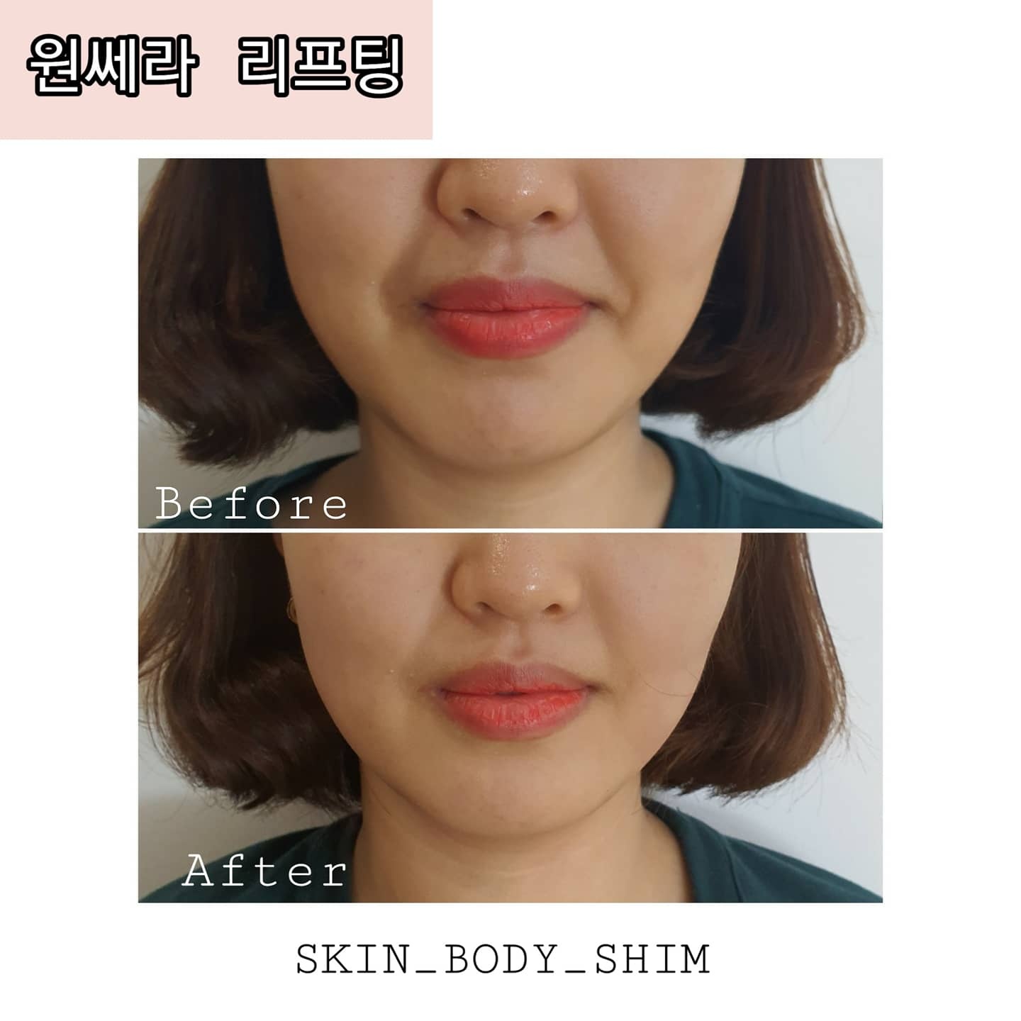 스킨앤바디 쉼