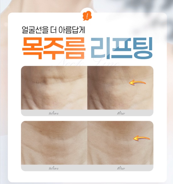 유투성형외과 전경