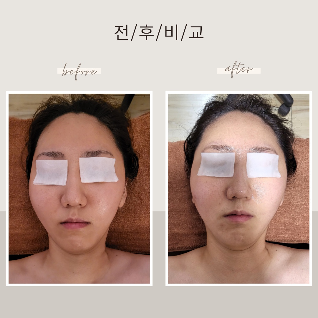 스킨앤바디 쉼