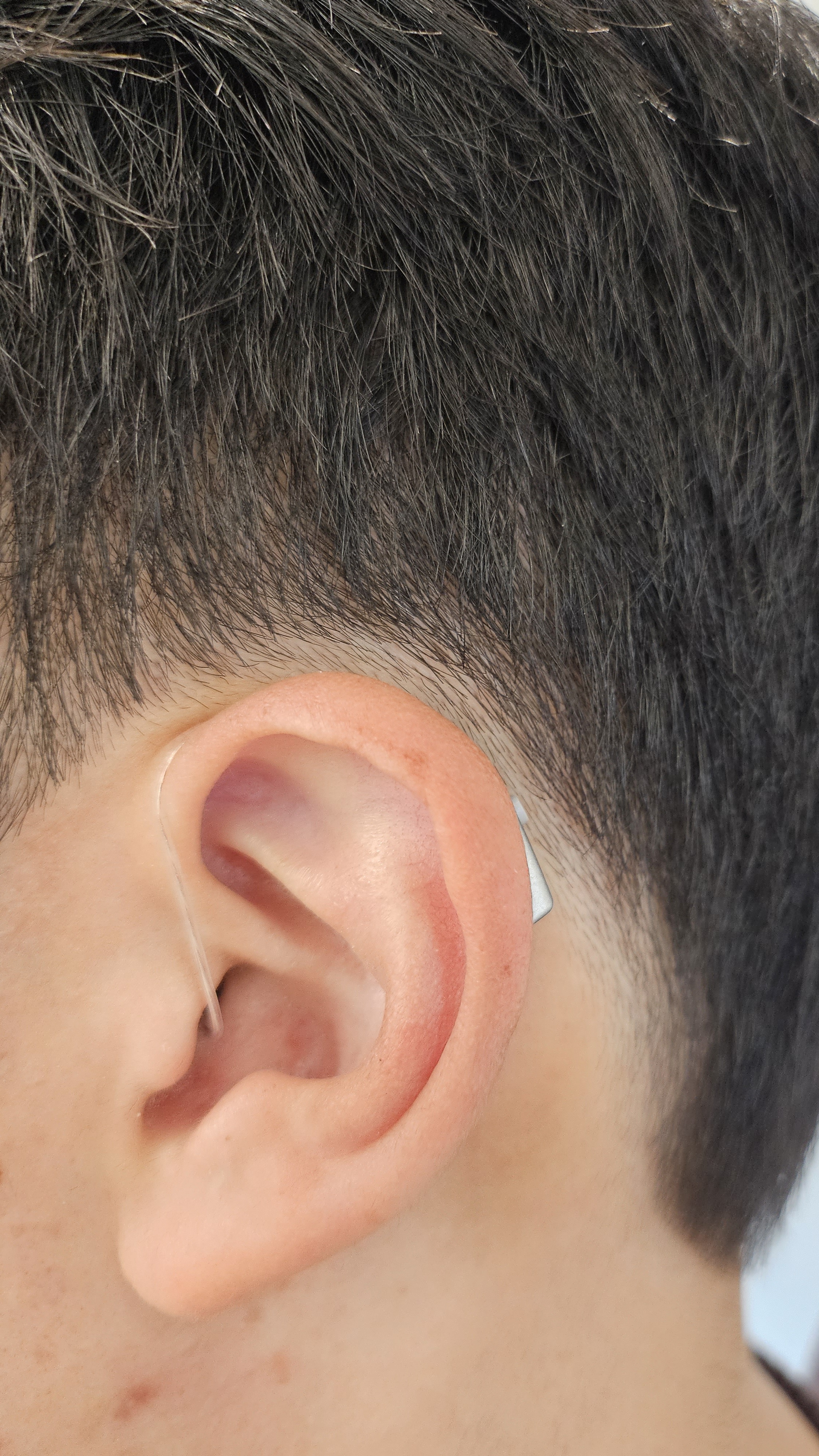 동성보청기 청각센터 경주점 대표 이미지