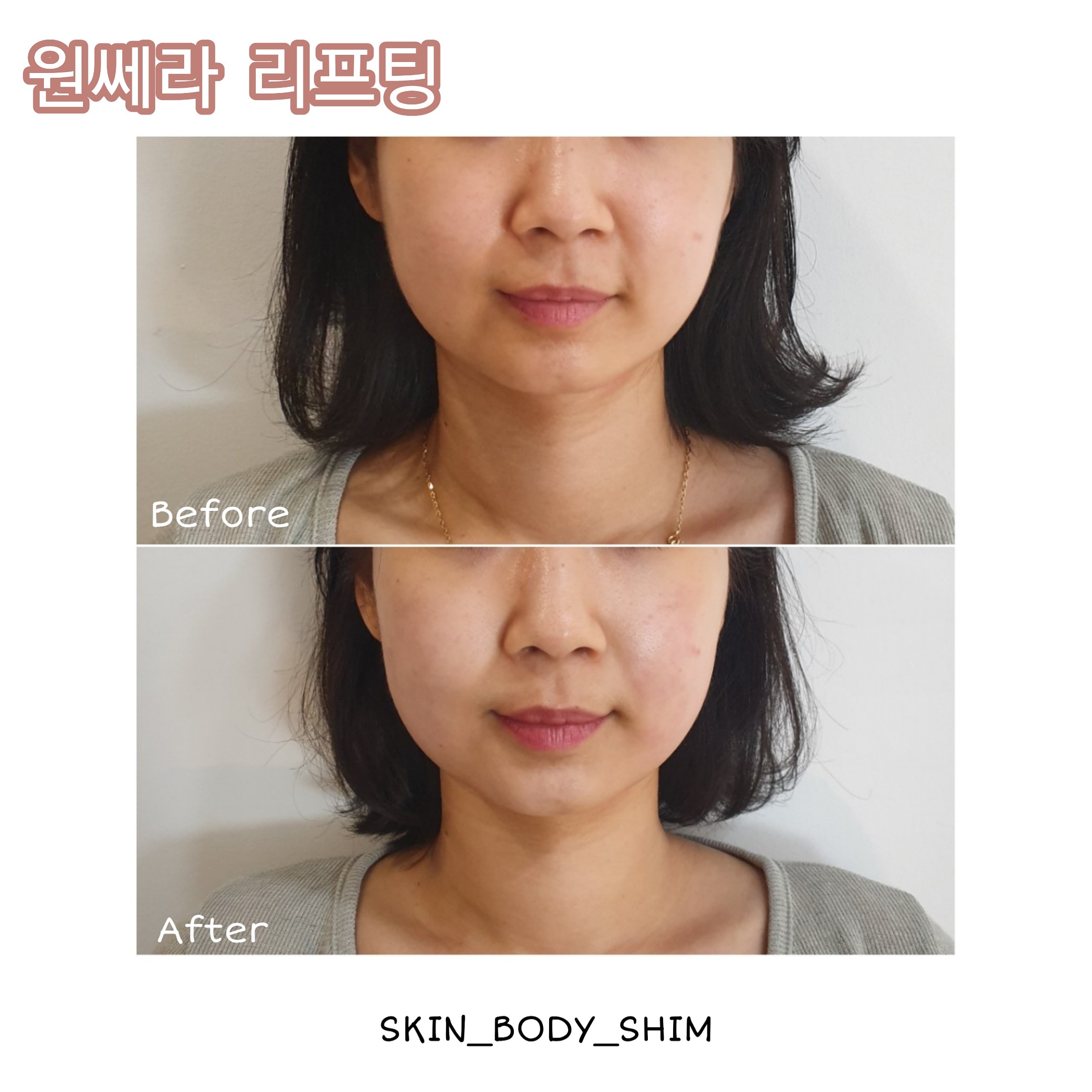 스킨앤바디 쉼