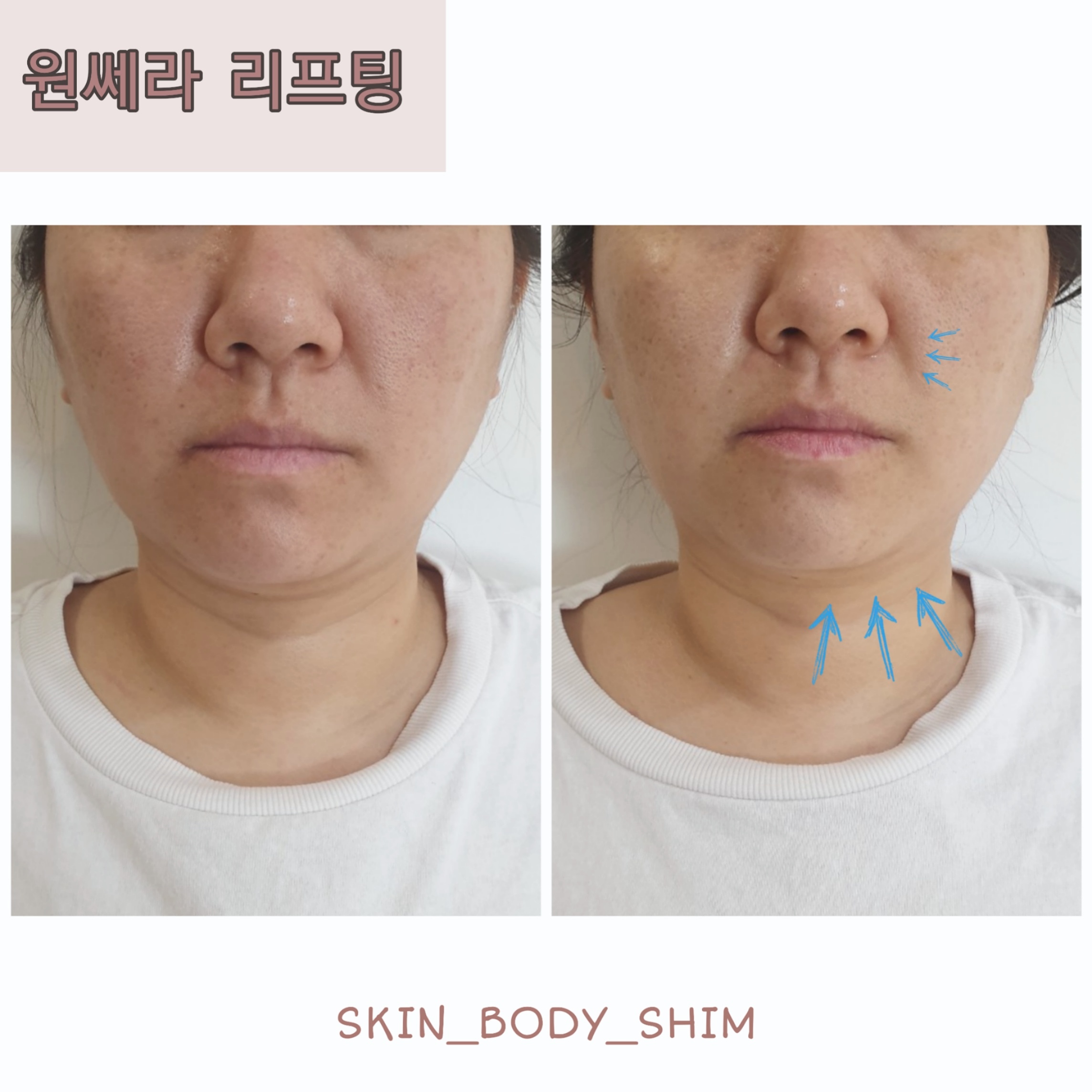 스킨앤바디 쉼