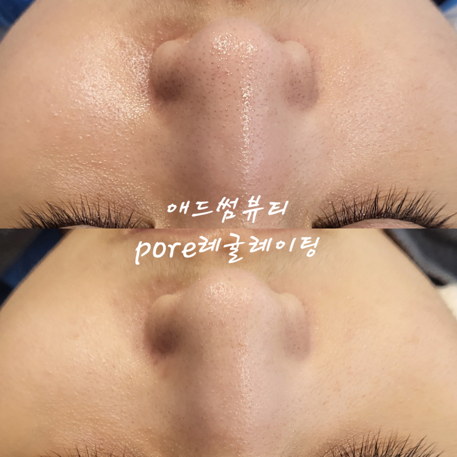 애드썸뷰티