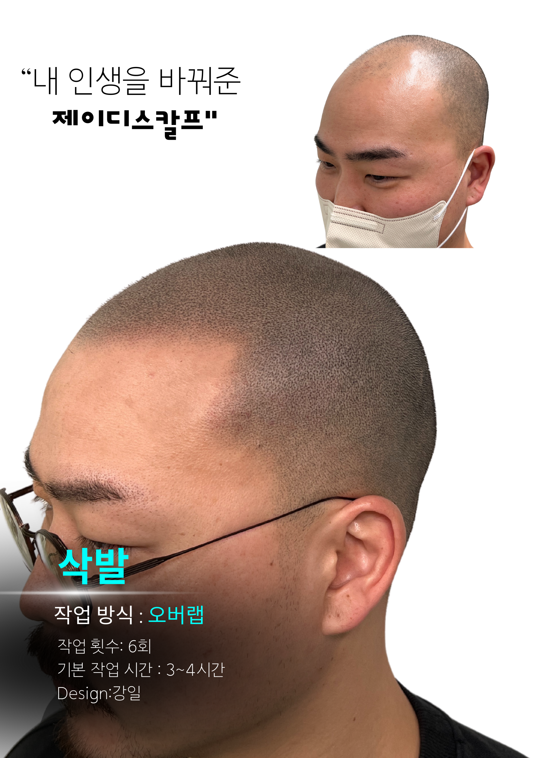 대전두피전문 제이디스칼프 대표 이미지