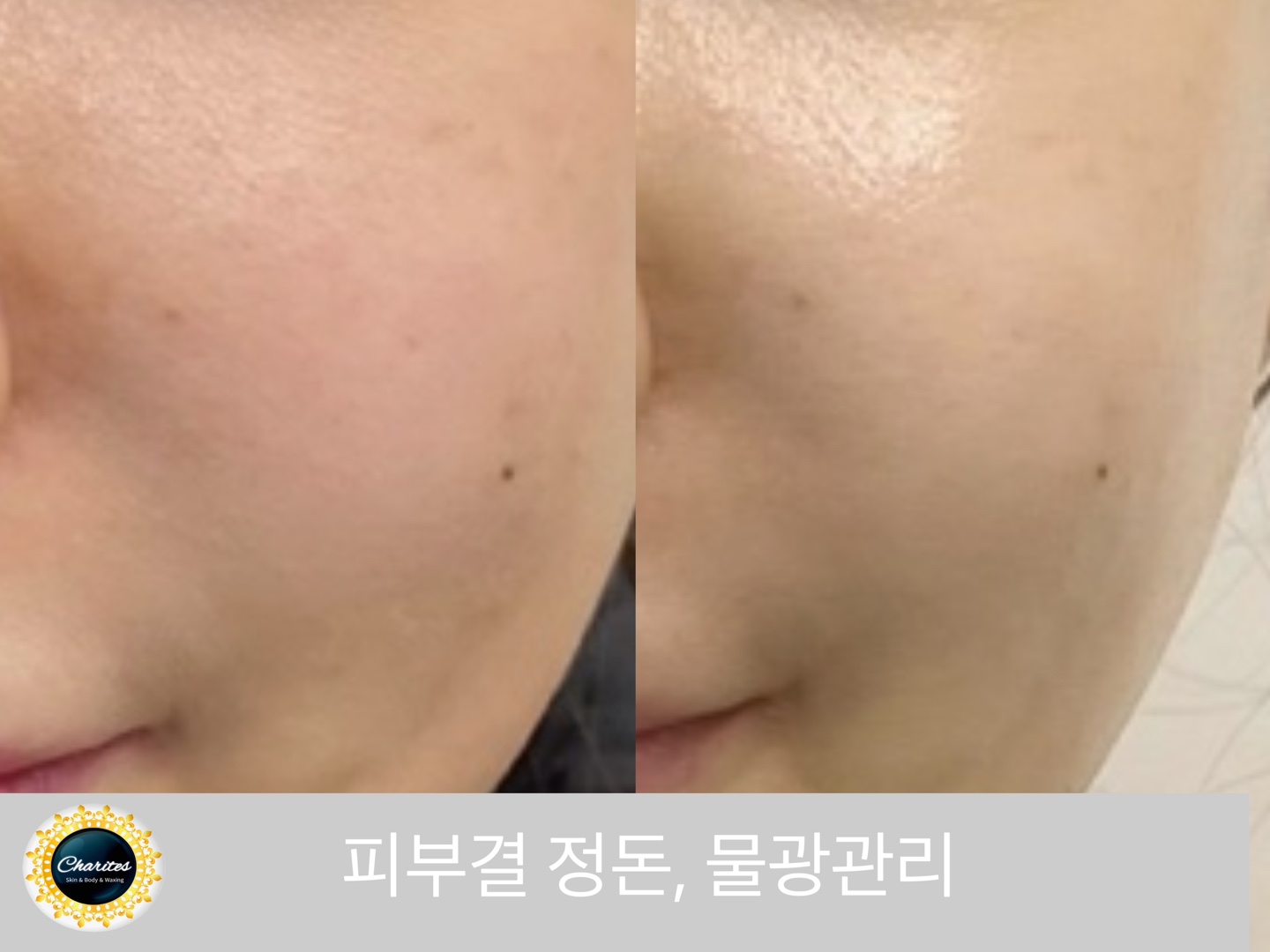 스파포레 노화연구소 대표 이미지