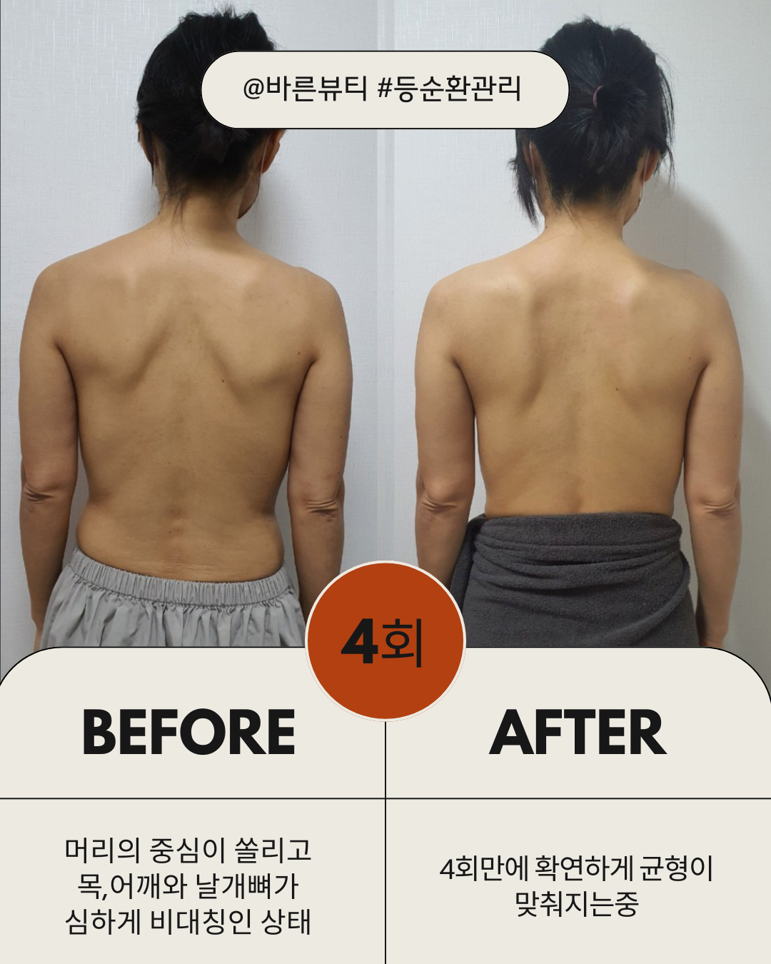 바른뷰티 photo 5