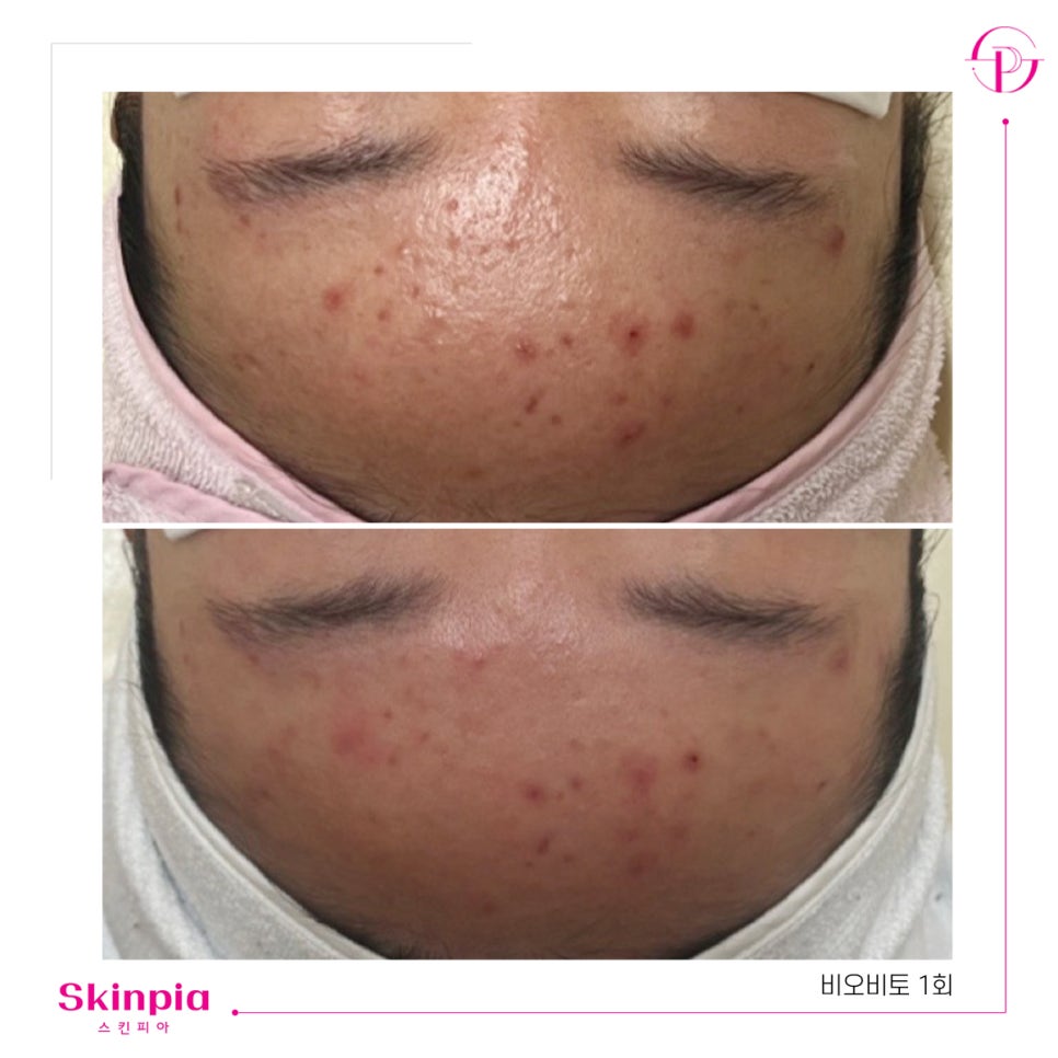 스킨피아 대표 이미지