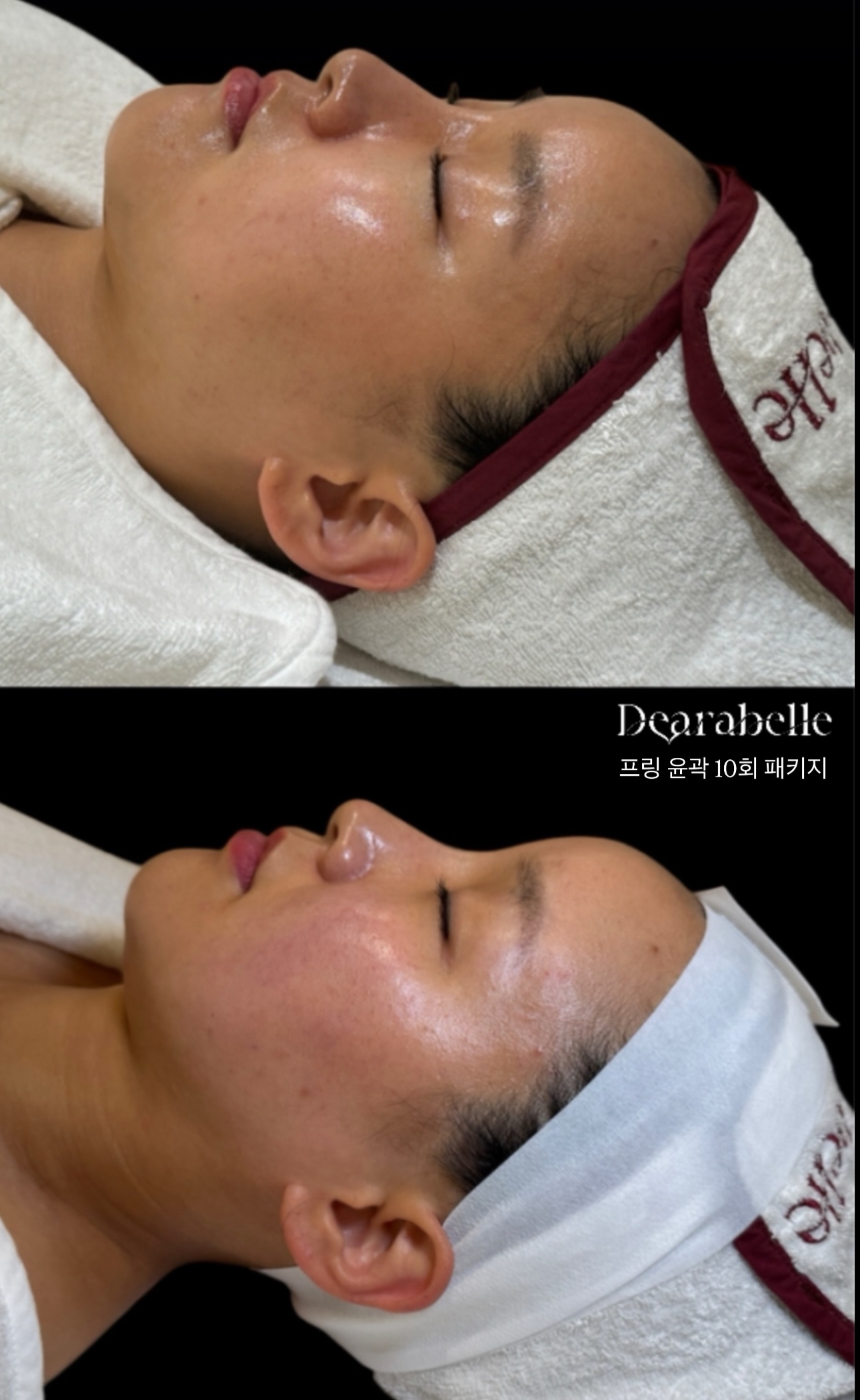 디어라벨 피부관리 대표 이미지