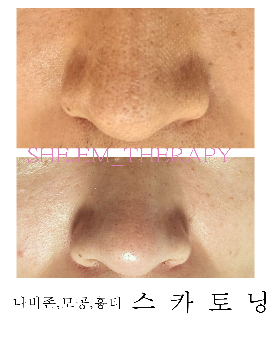쉼테라피 photo 10