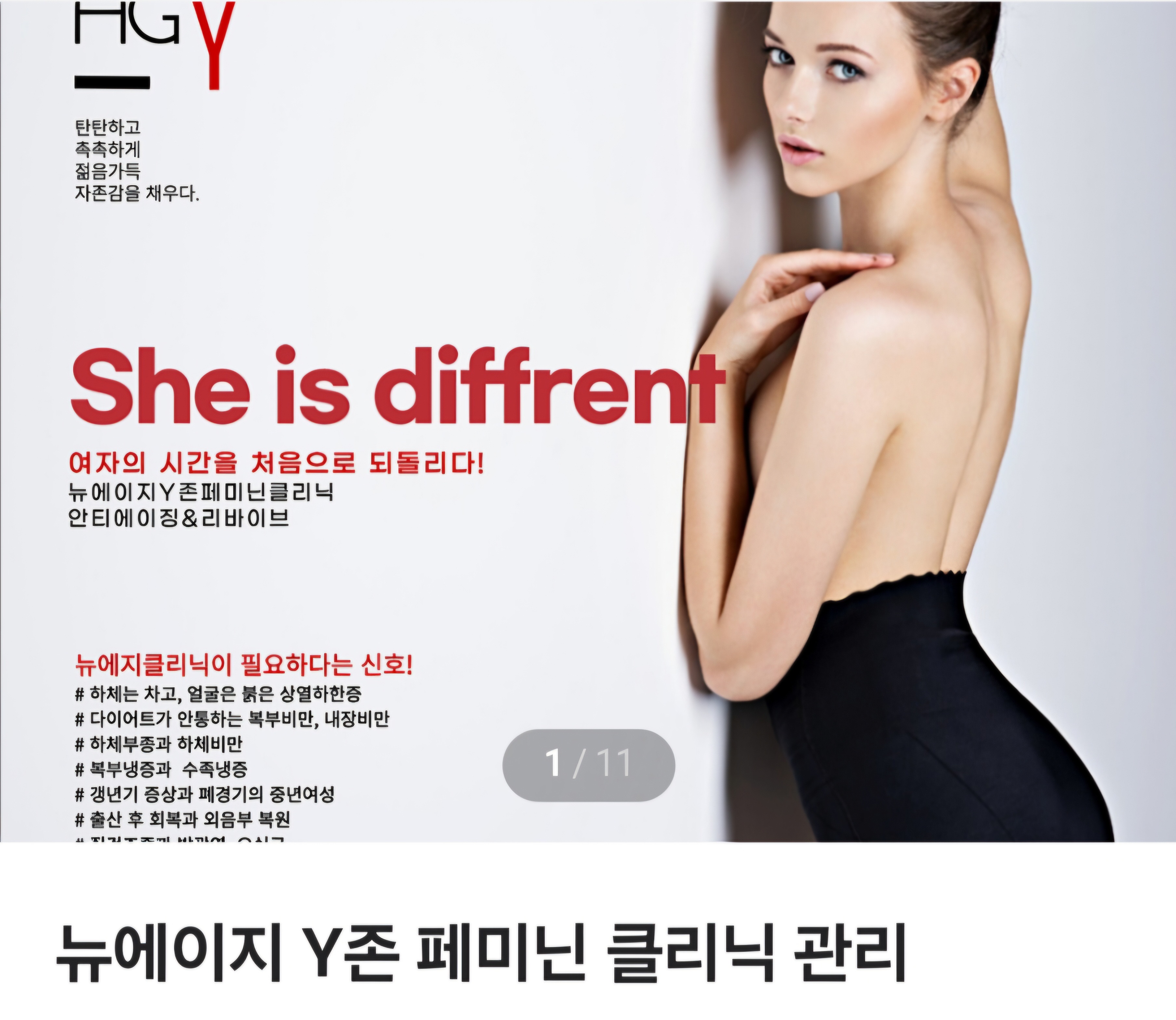 비타C스킨갤러리