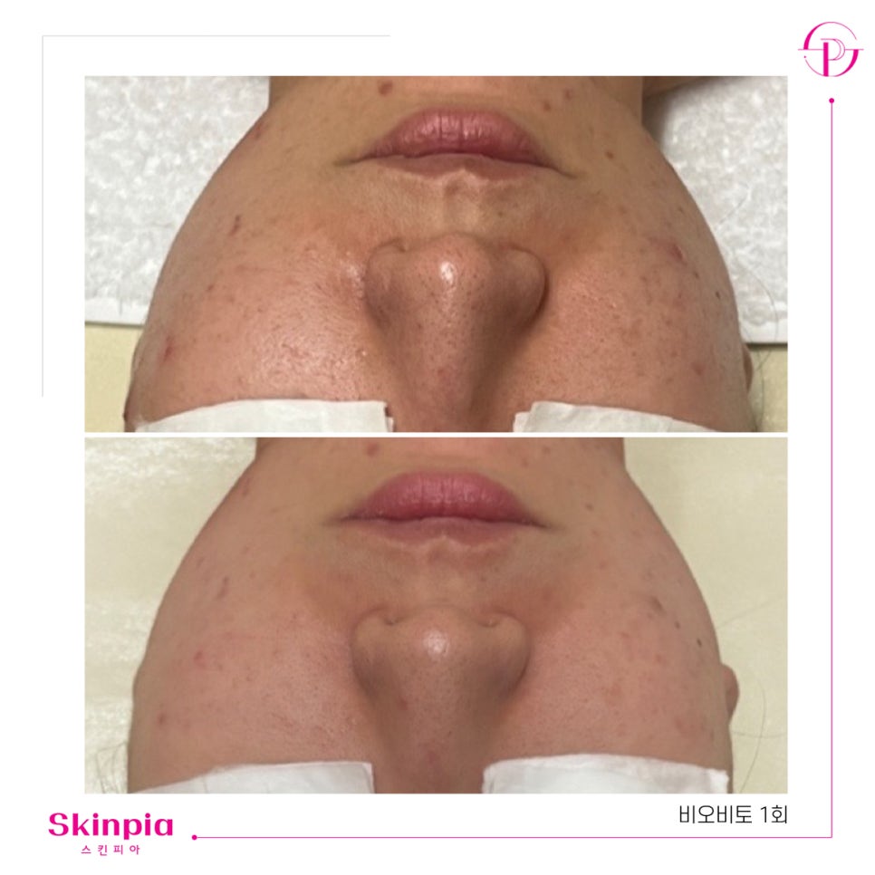 스킨피아 대표 이미지