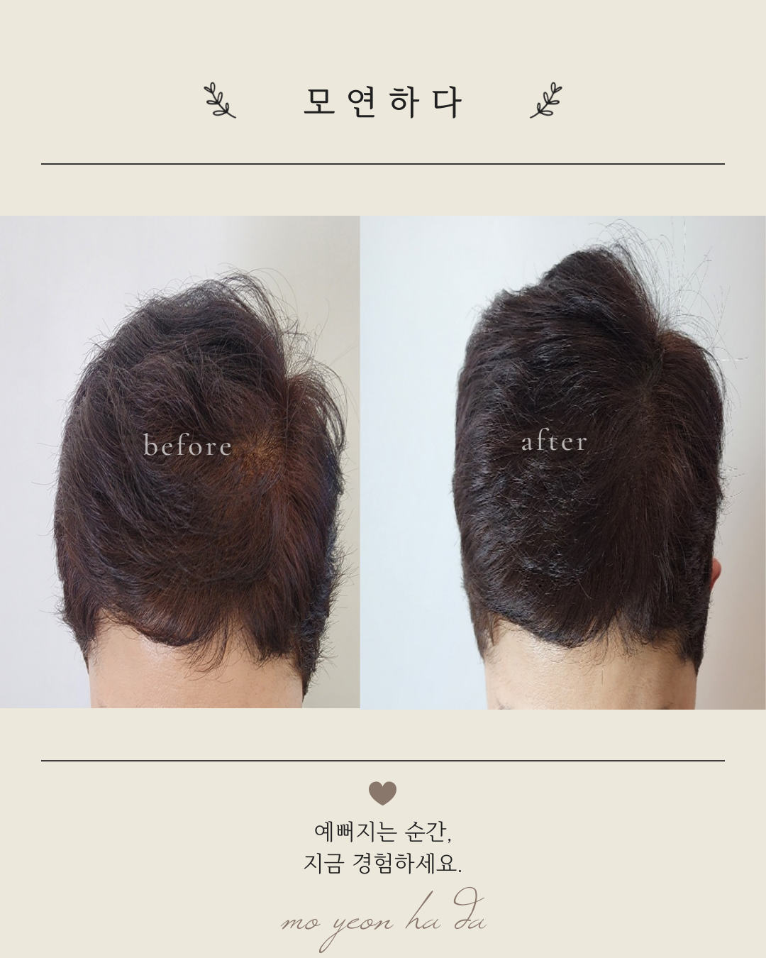 모연하다 대표 이미지