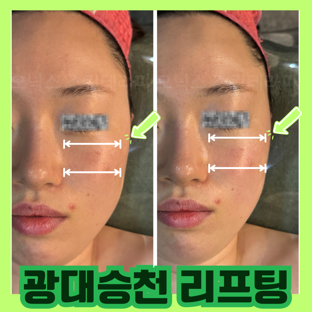 오닉스 스킨테라피