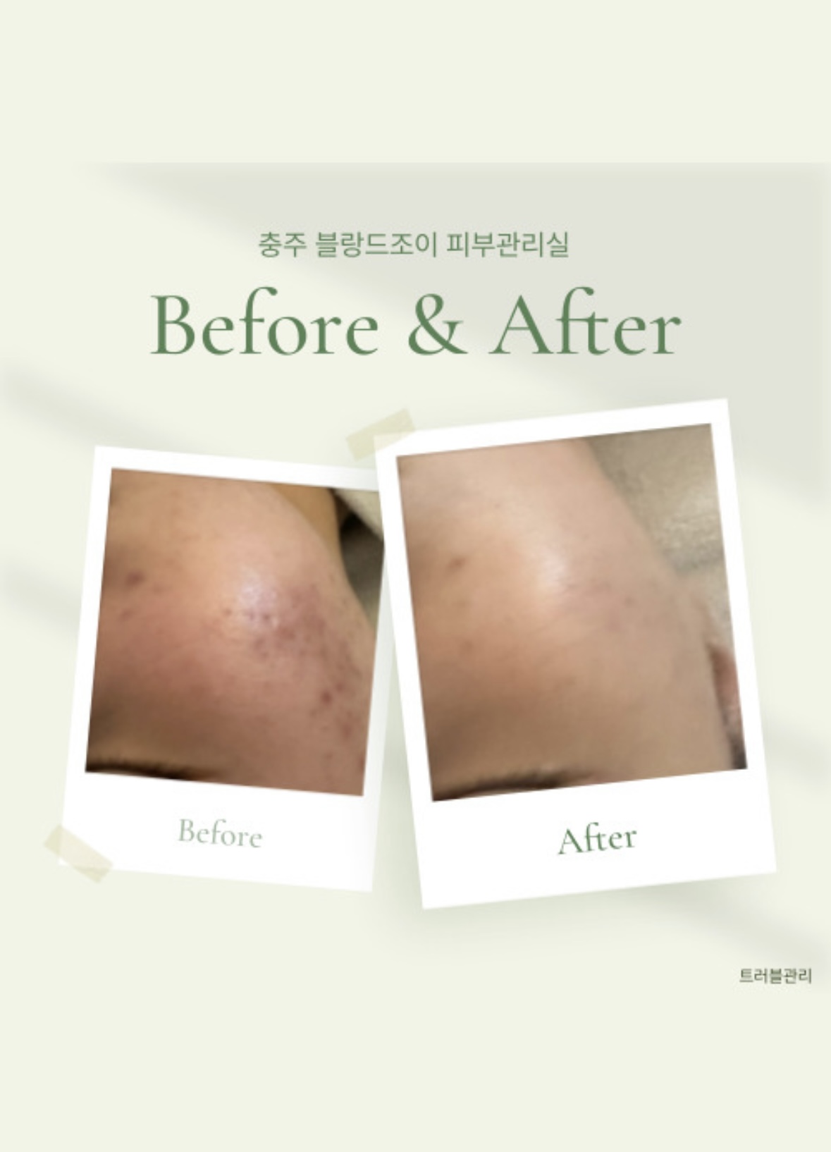 블랑드조이