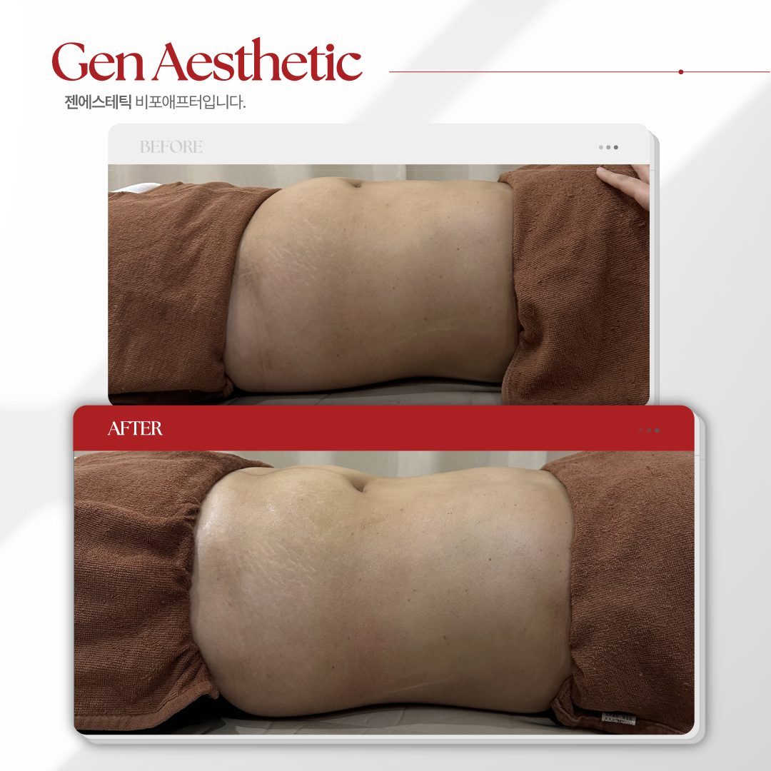 젠에스테틱 원주점 대표 이미지