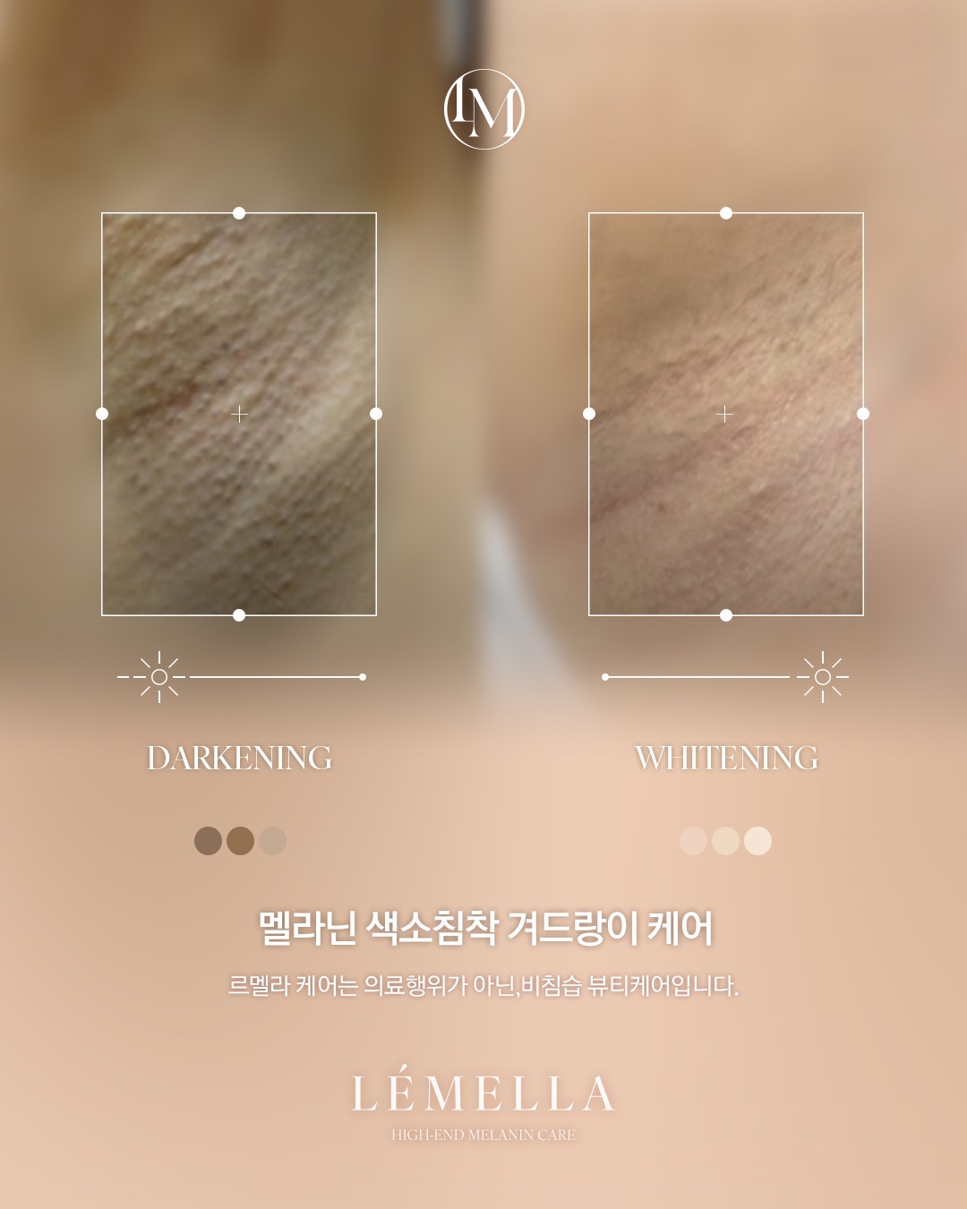 모브스킨 대표 이미지