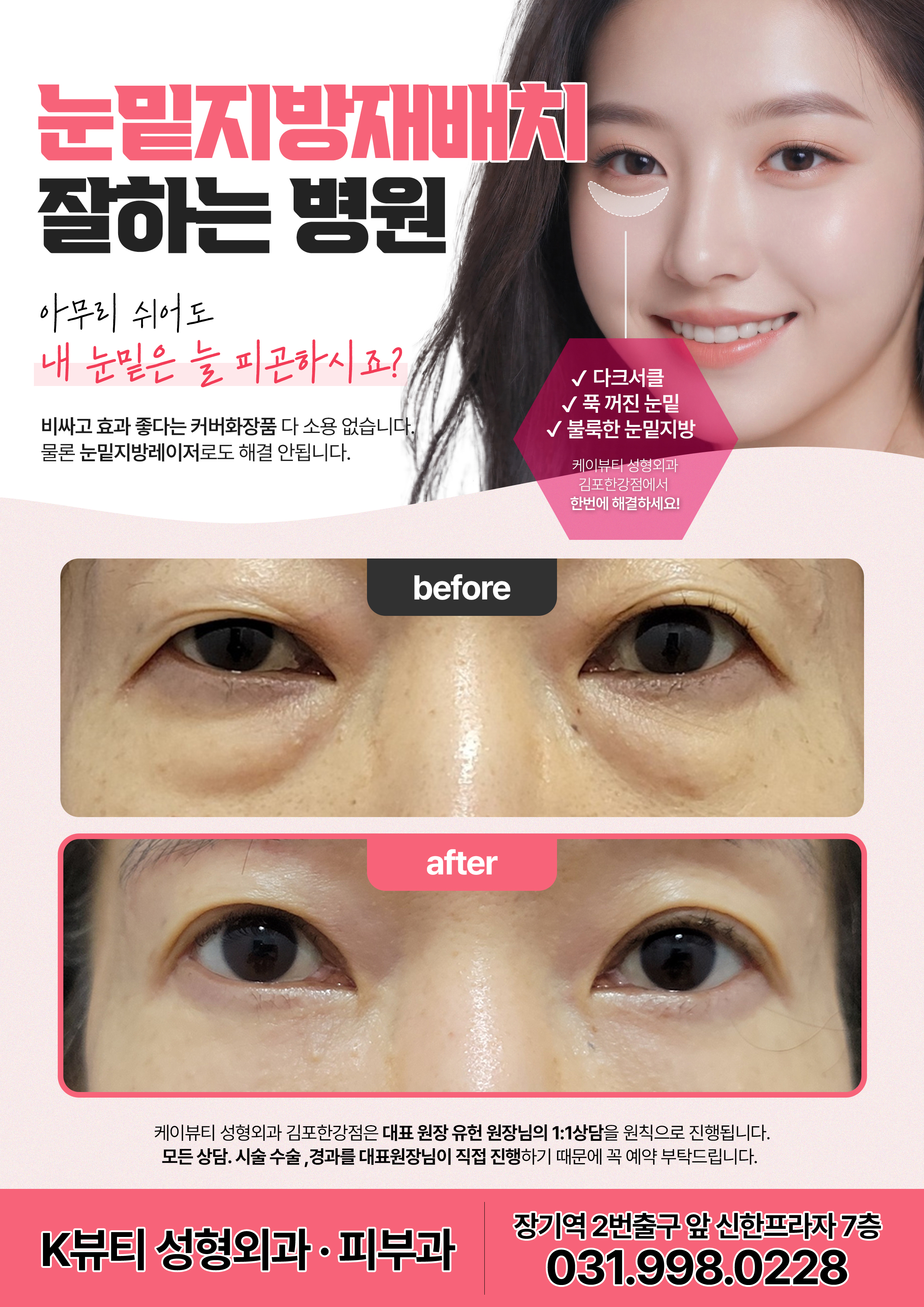 케이뷰티성형외과의원 대표 이미지