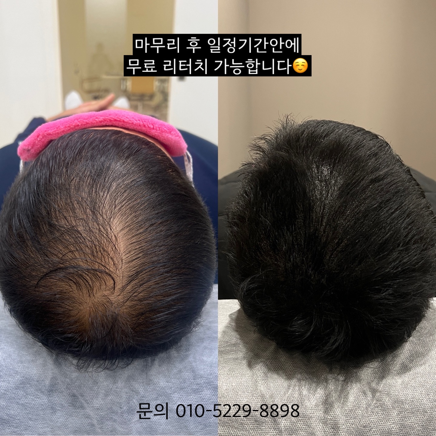 에이아이앤비뷰티