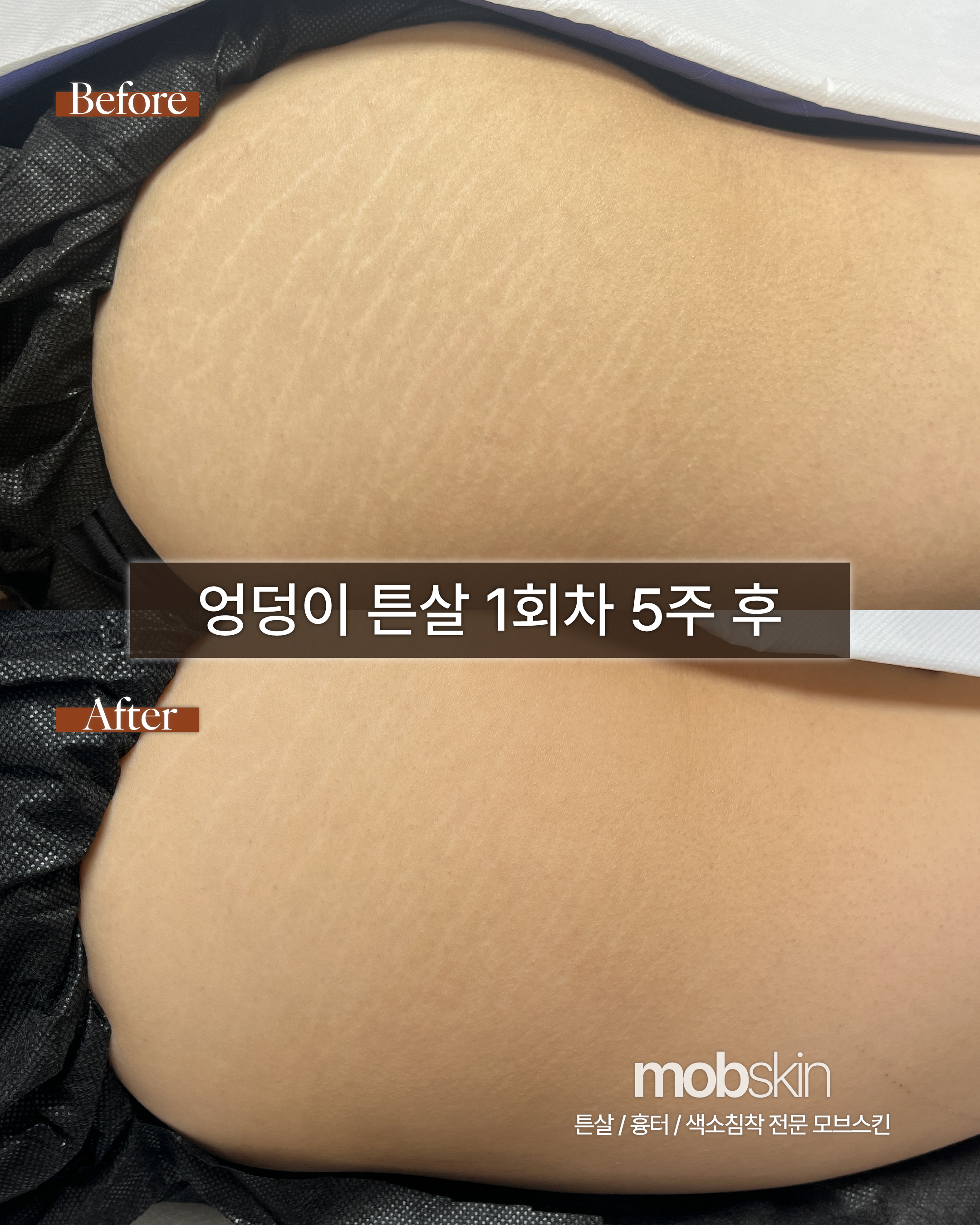 모브스킨 대표 이미지